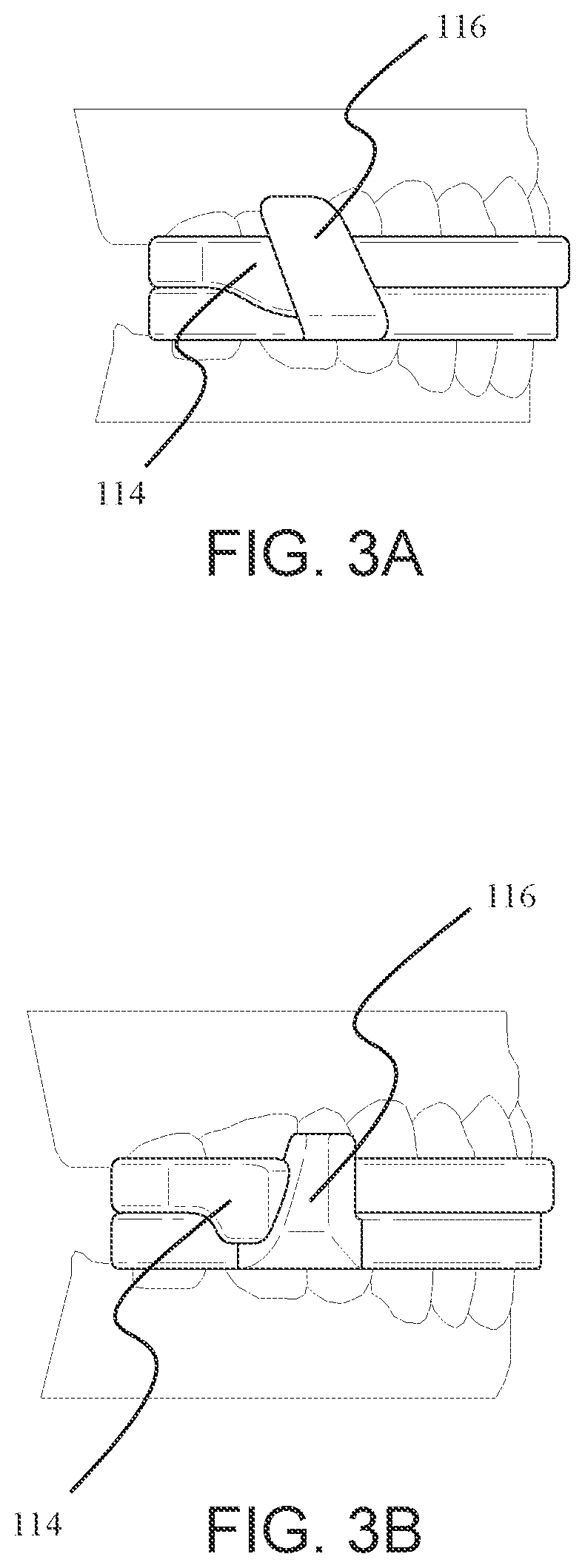Patent US12147214 Figure 3 – Computer aided design matrix for the manufacture of dental devices
