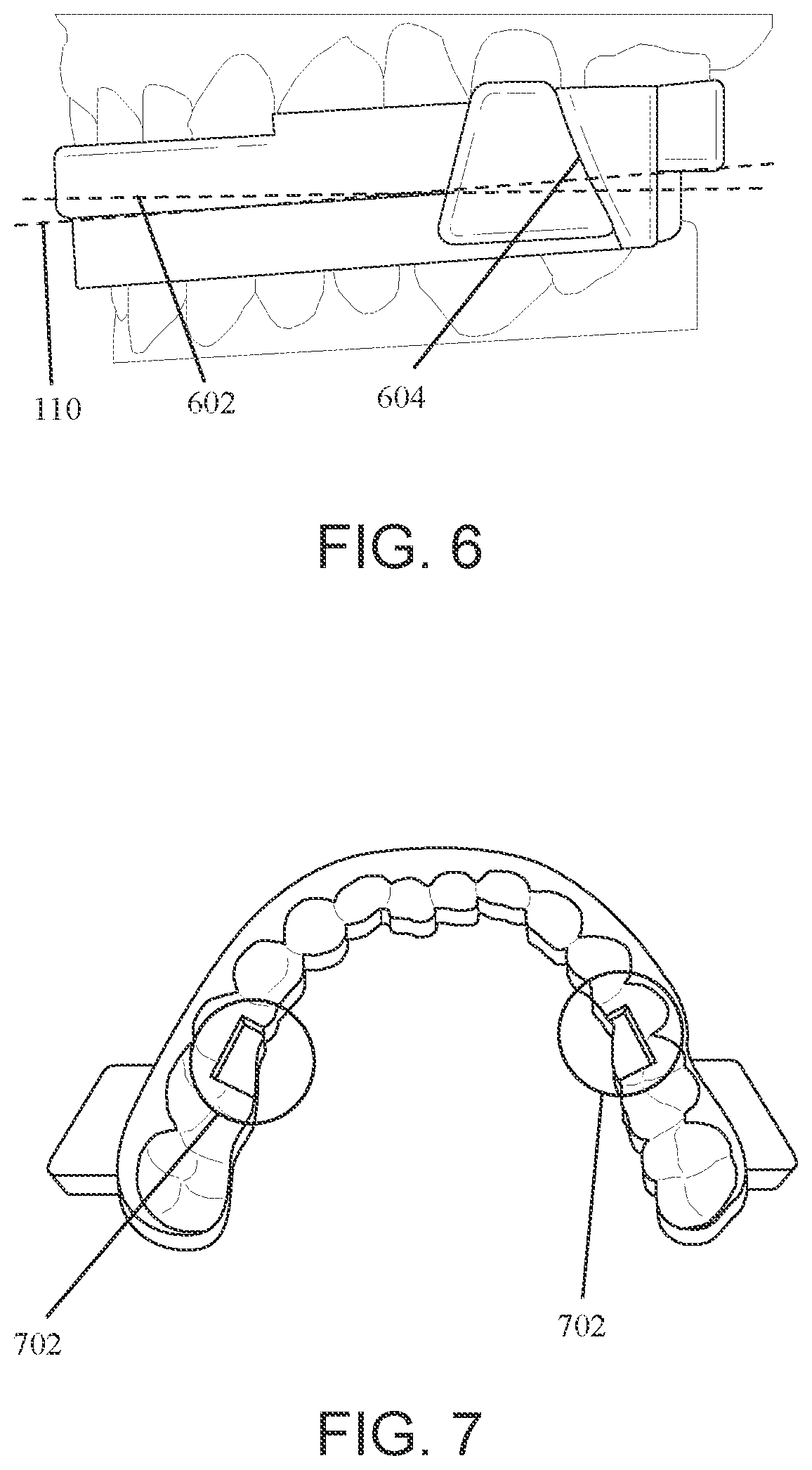 Patent US12147214 Figure 5 – Computer aided design matrix for the manufacture of dental devices