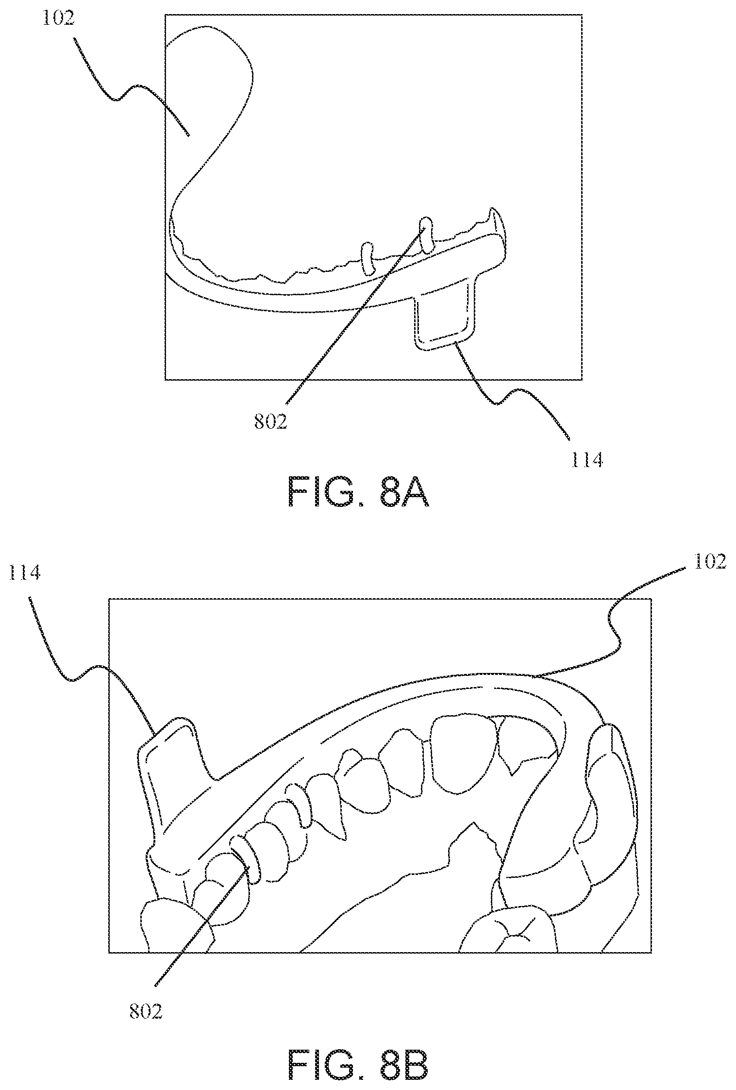 Patent US12147214 Figure 6 – Computer aided design matrix for the manufacture of dental devices