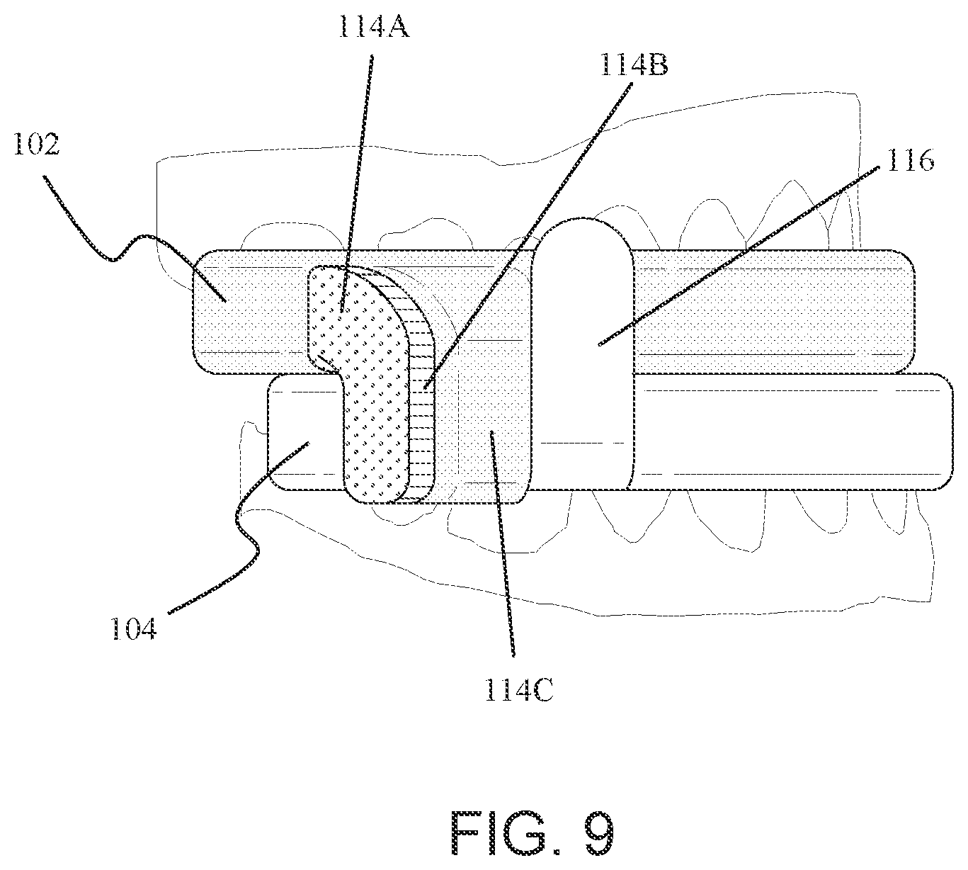 Patent US12147214 Figure 7 – Computer aided design matrix for the manufacture of dental devices