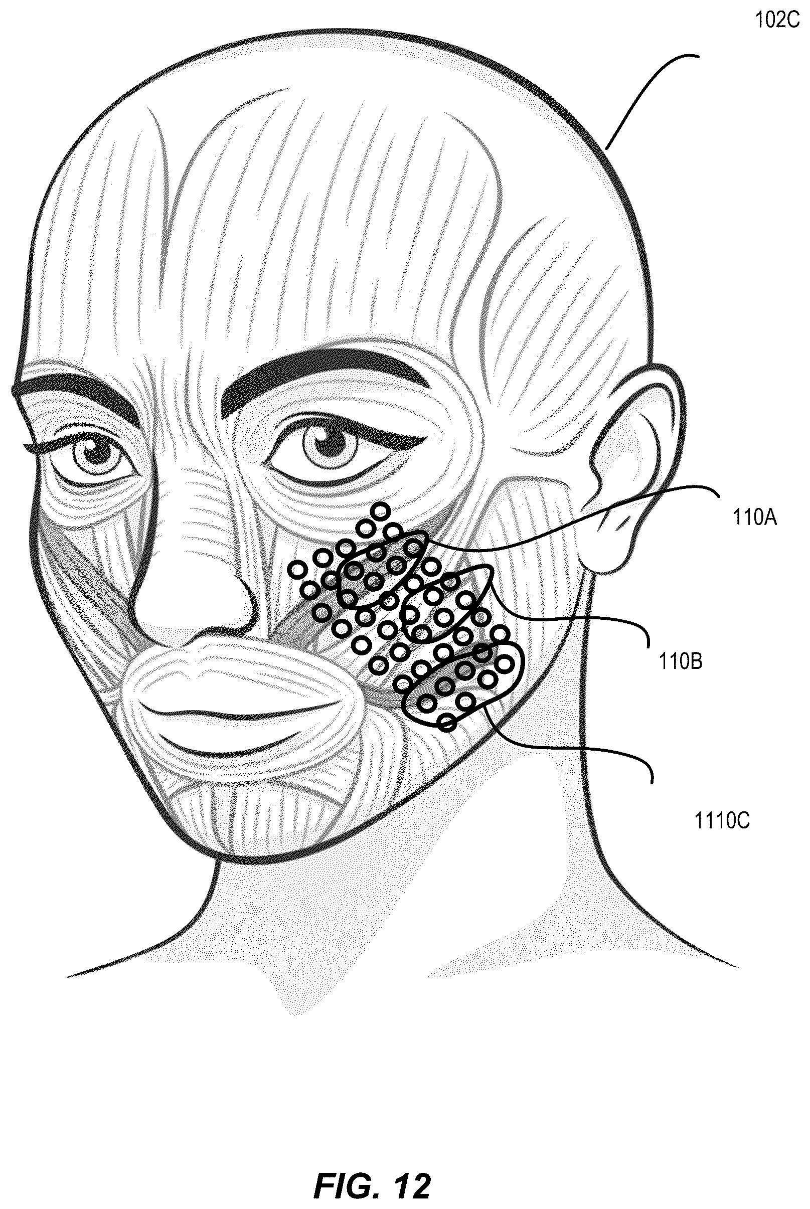 Patent US12147521 Figure 13 – Threshold facial micromovement intensity triggers interpretation