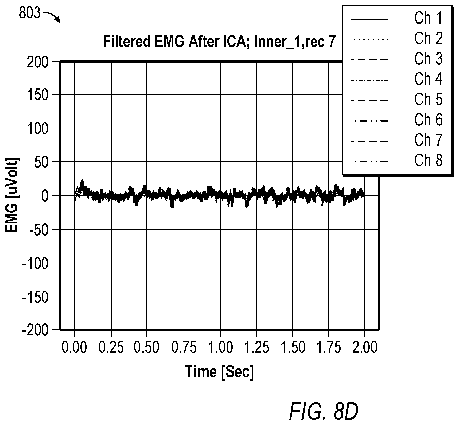 Patent US12147601 Figure 11 – Removing eye blinks from EMG speech signals