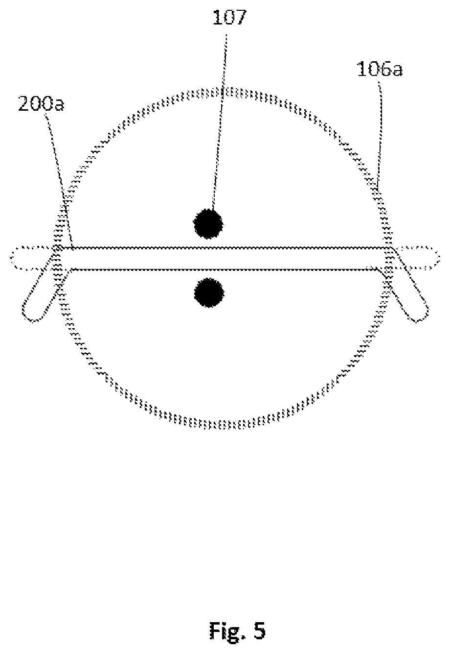 Patent US12155077 Figure 5 – Interconnecting structure for energy storage cells in an energy storage device