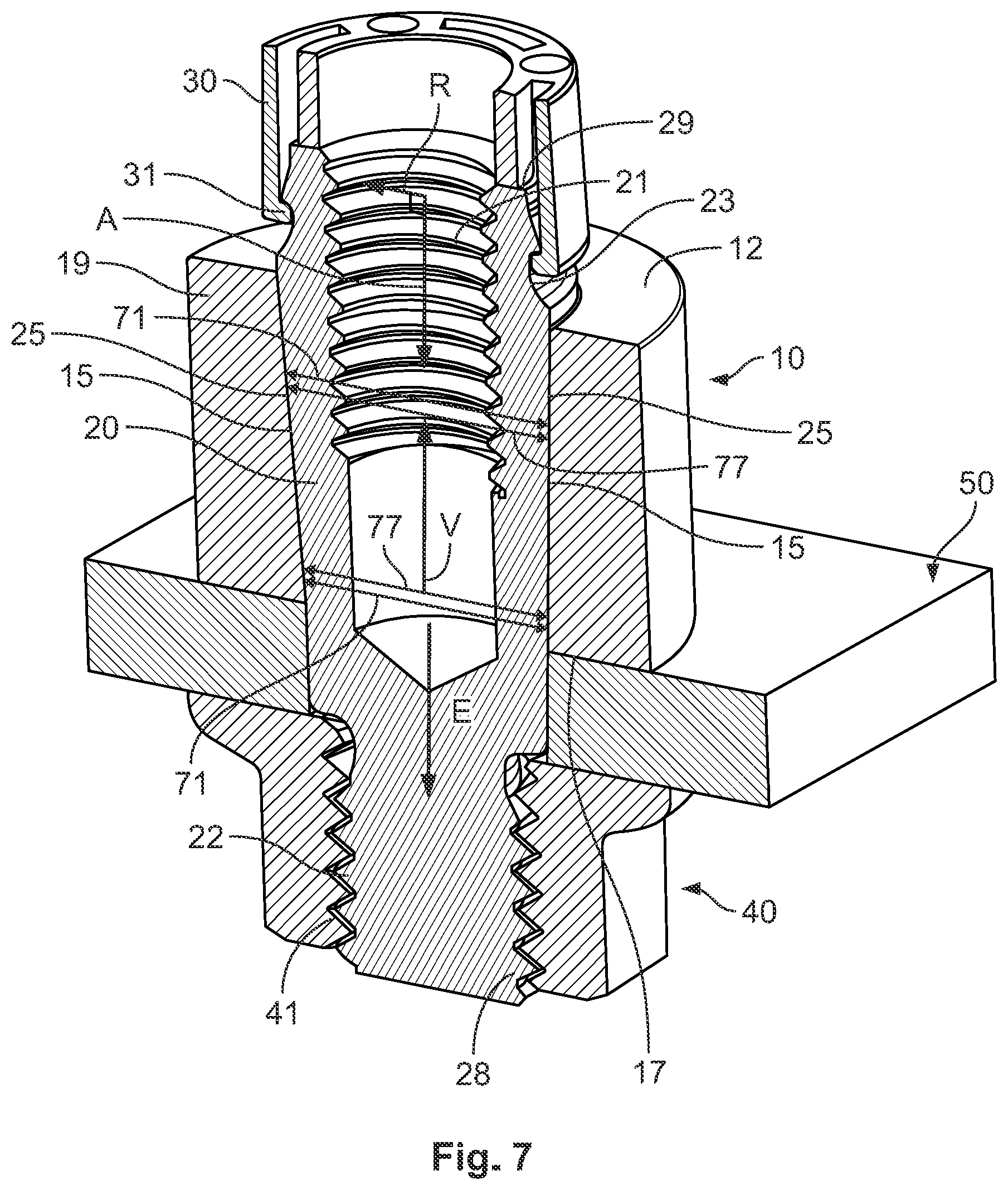 Patent US12155162 Figure 7 – Bus bar contact for attachment to a bus bar, and method for attaching a bus bar contact