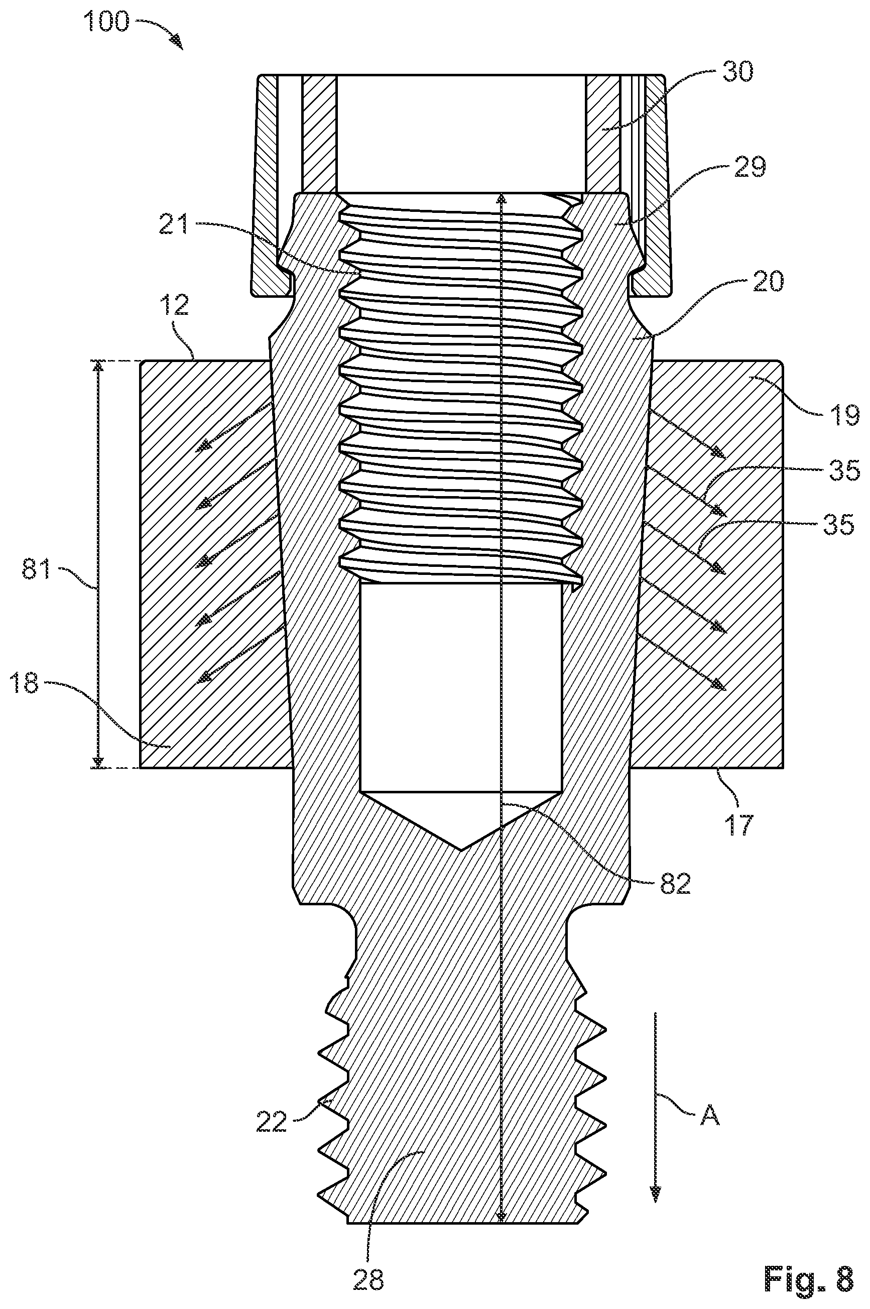 Patent US12155162 Figure 8 – Bus bar contact for attachment to a bus bar, and method for attaching a bus bar contact