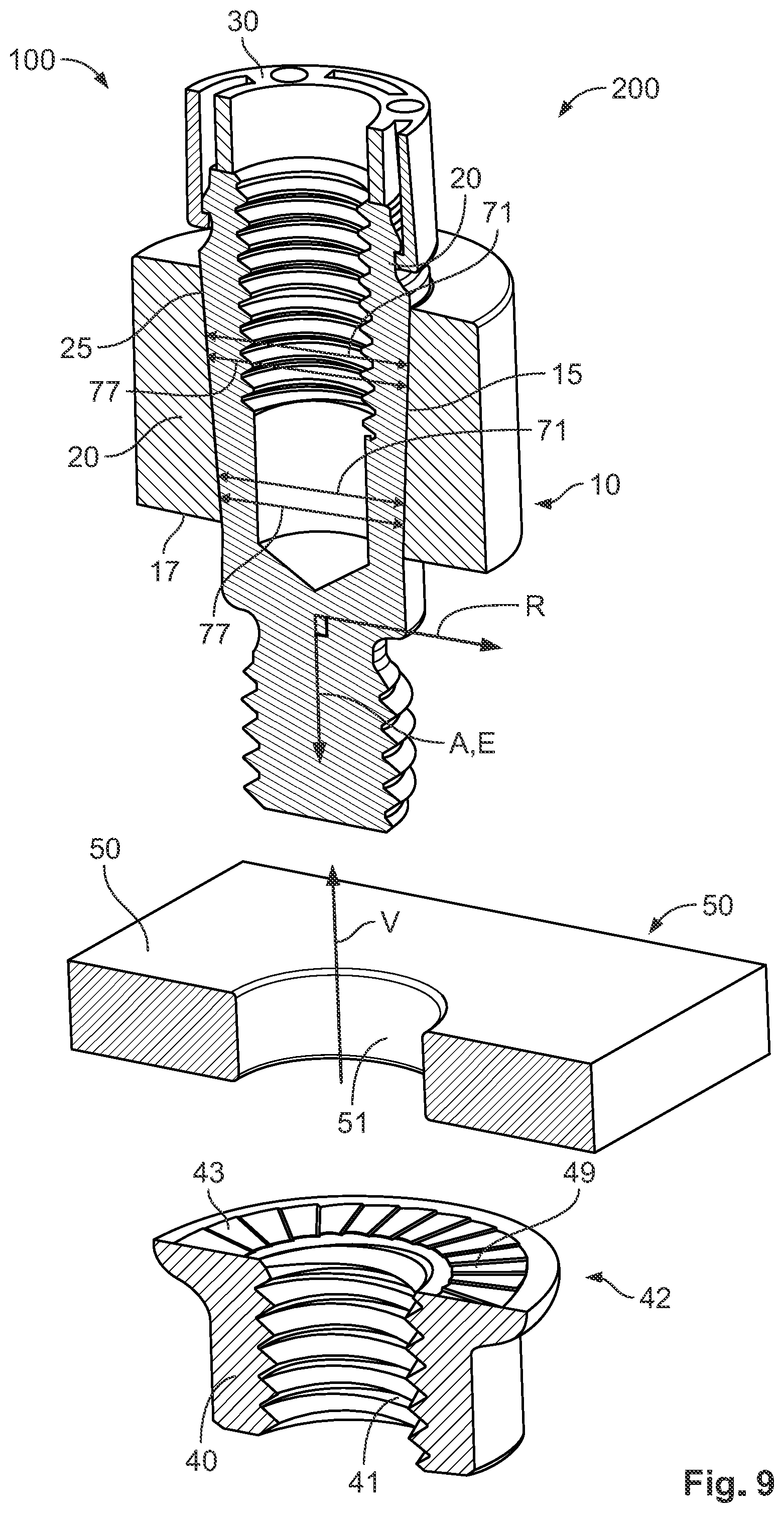 Patent US12155162 Figure 9 – Bus bar contact for attachment to a bus bar, and method for attaching a bus bar contact