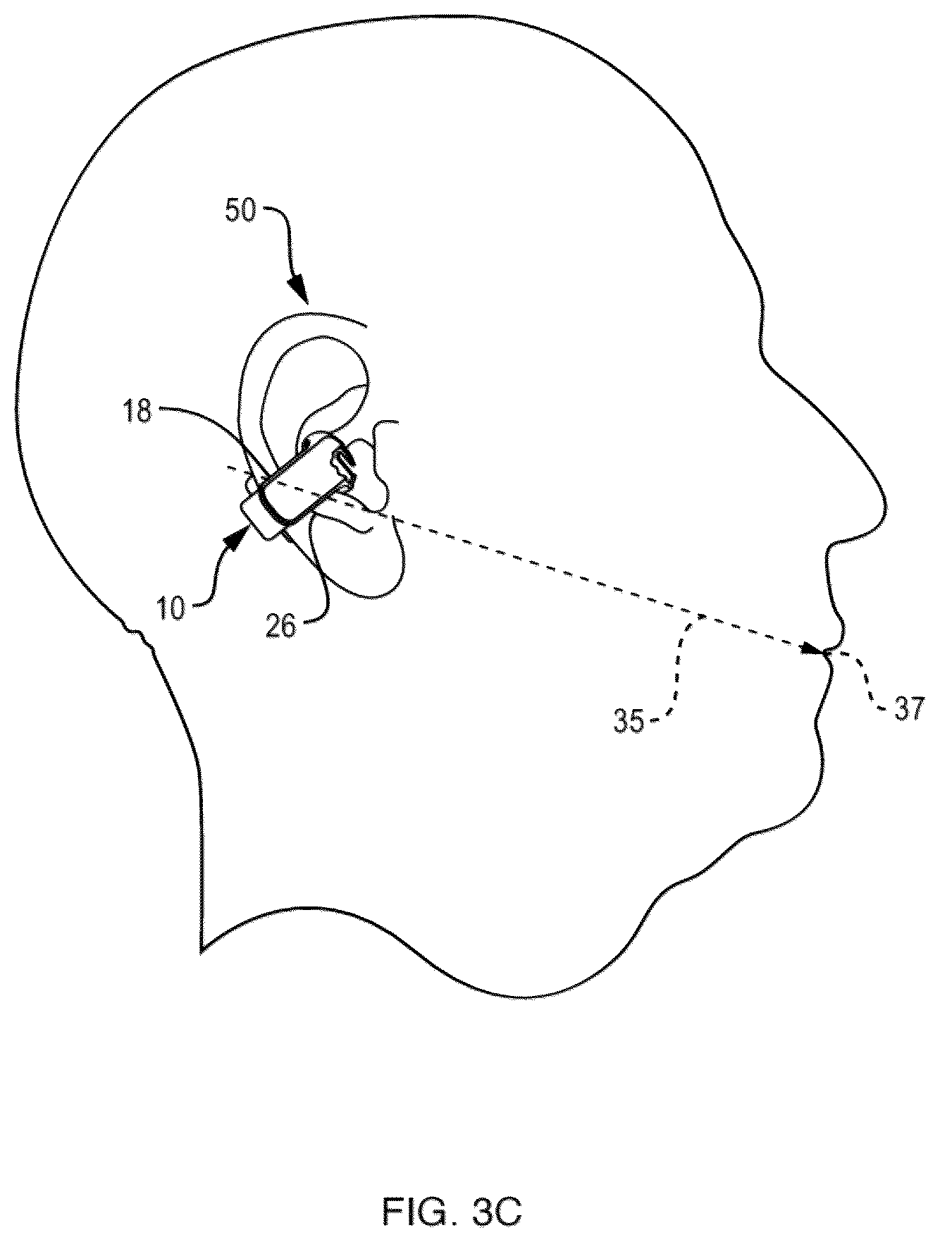 Patent US12155984 Figure 5 – Open-ear headphone