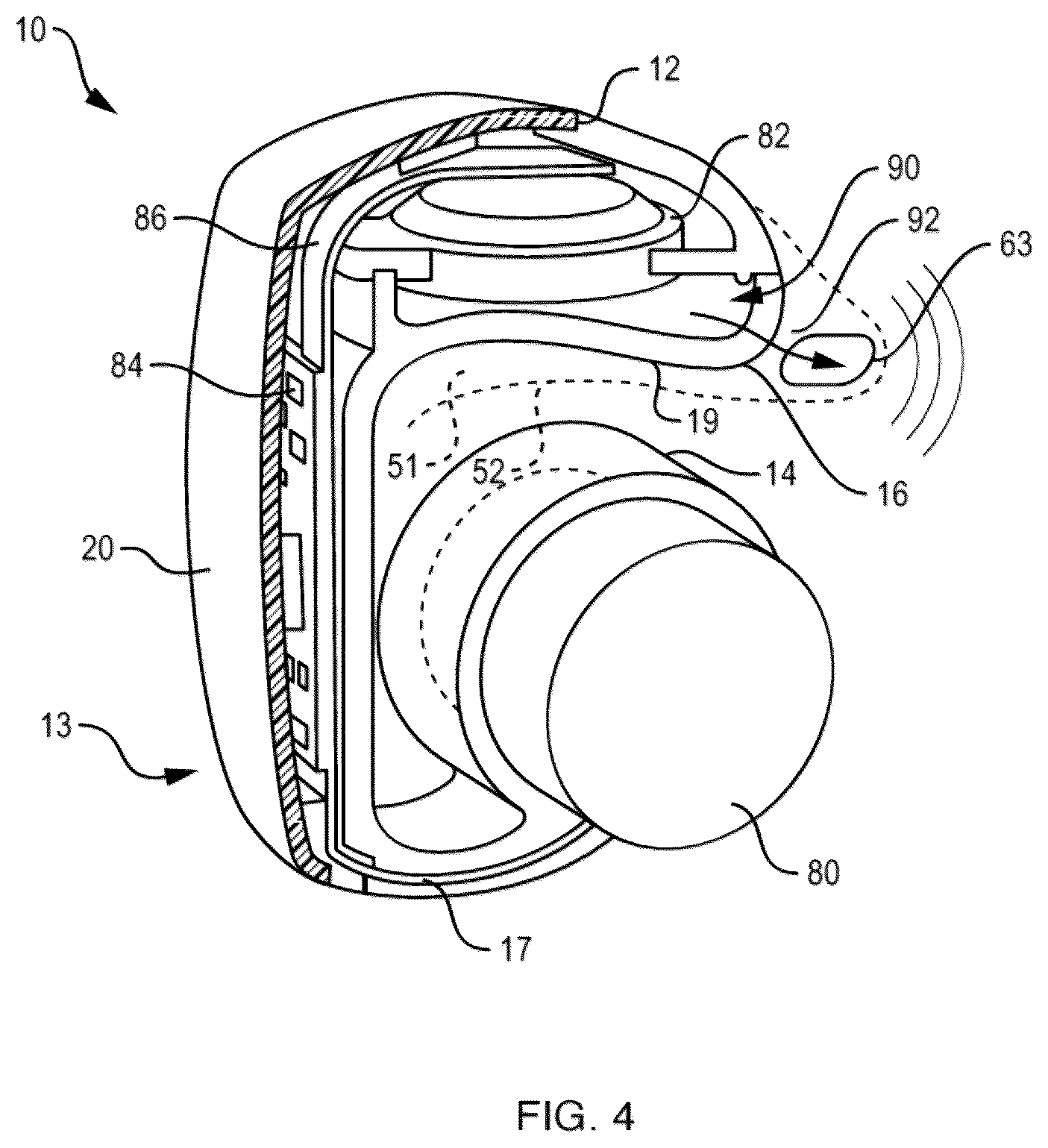 Patent US12155984 Figure 6 – Open-ear headphone
