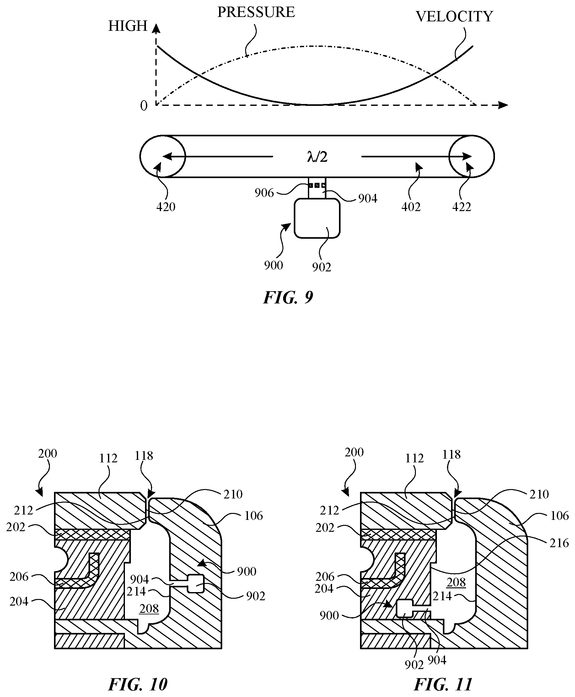 Patent US12155994 Figure 4 – Acoustic resonators for microphones