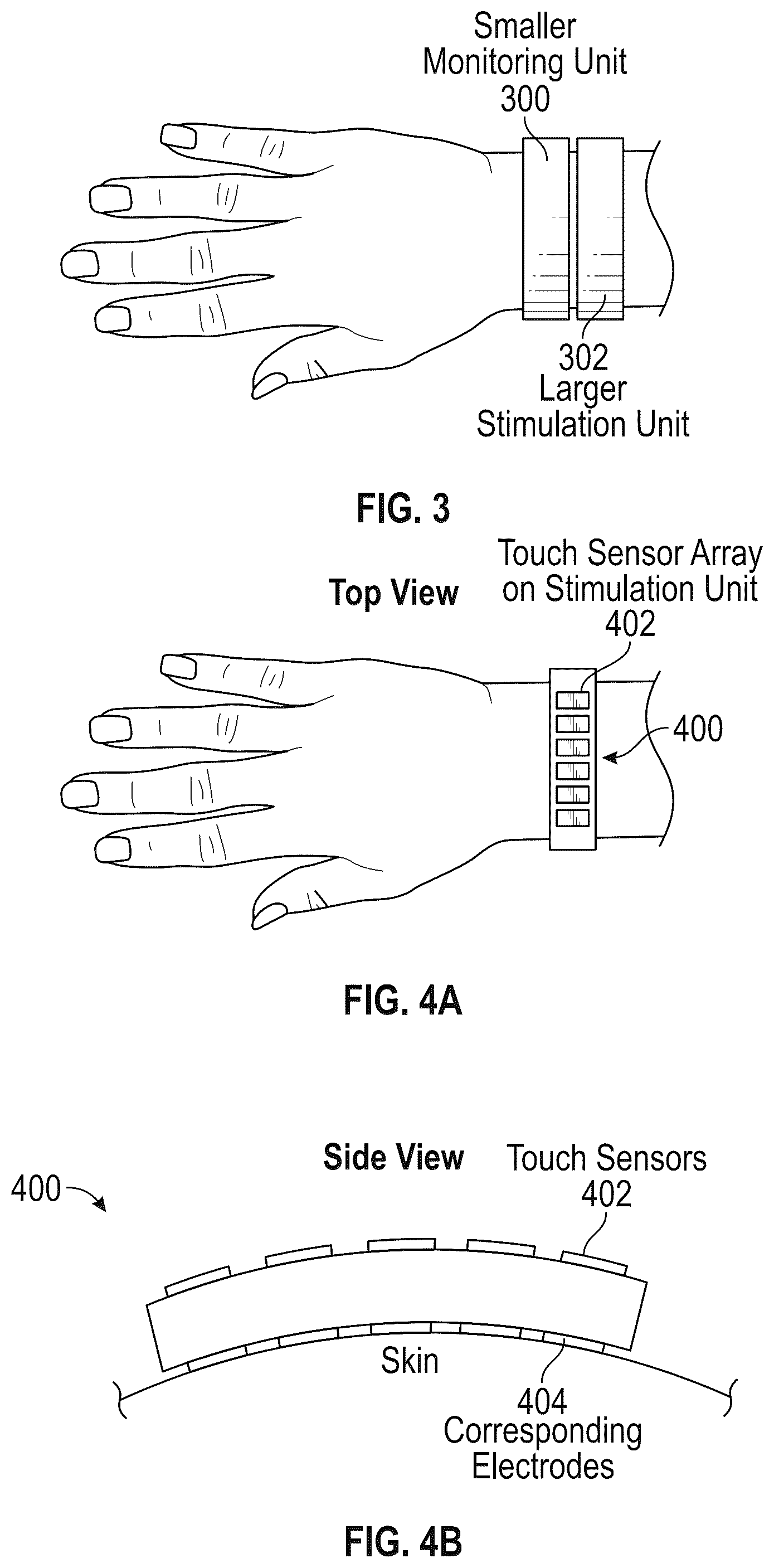 Patent US12157001 Figure 4 – Systems and methods for peripheral nerve stimulation to treat tremor with detachable therapy and monitoring units
