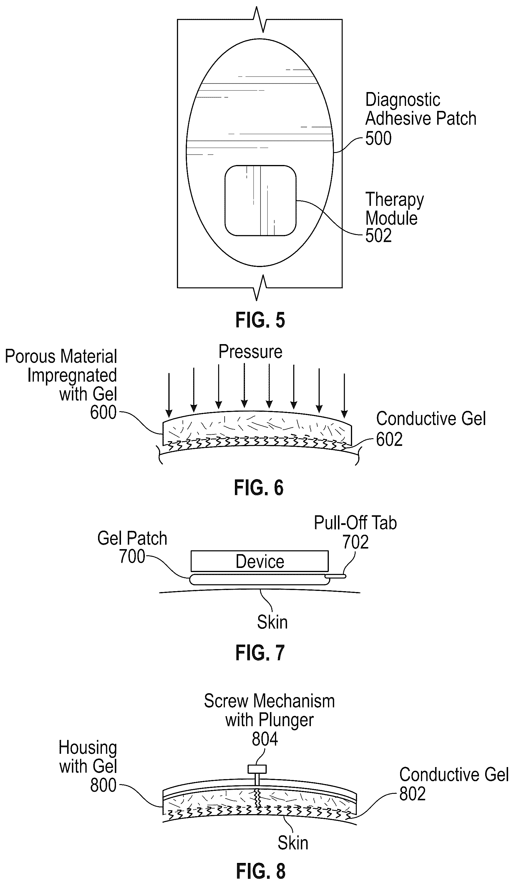 Patent US12157001 Figure 5 – Systems and methods for peripheral nerve stimulation to treat tremor with detachable therapy and monitoring units