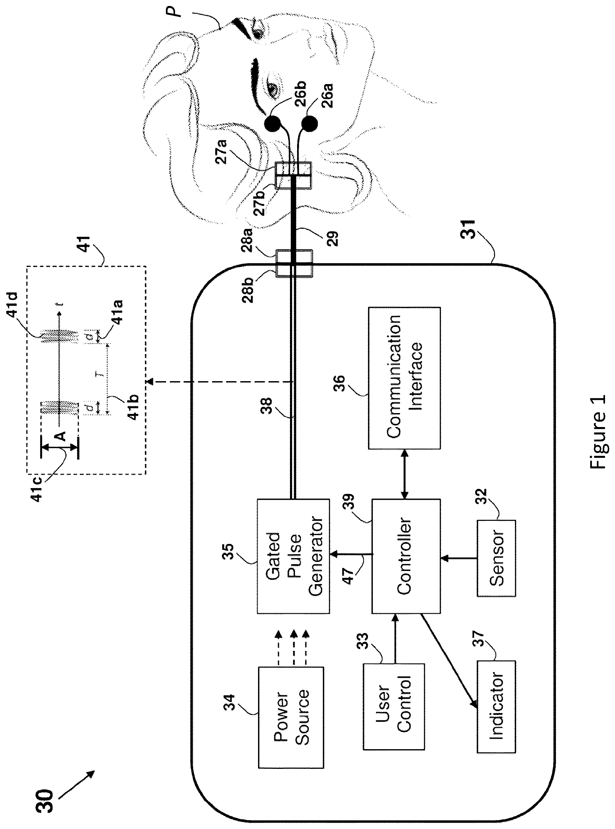 Patent US12157002 — Wearable electrode device having magnetic connectors — Figure 1
