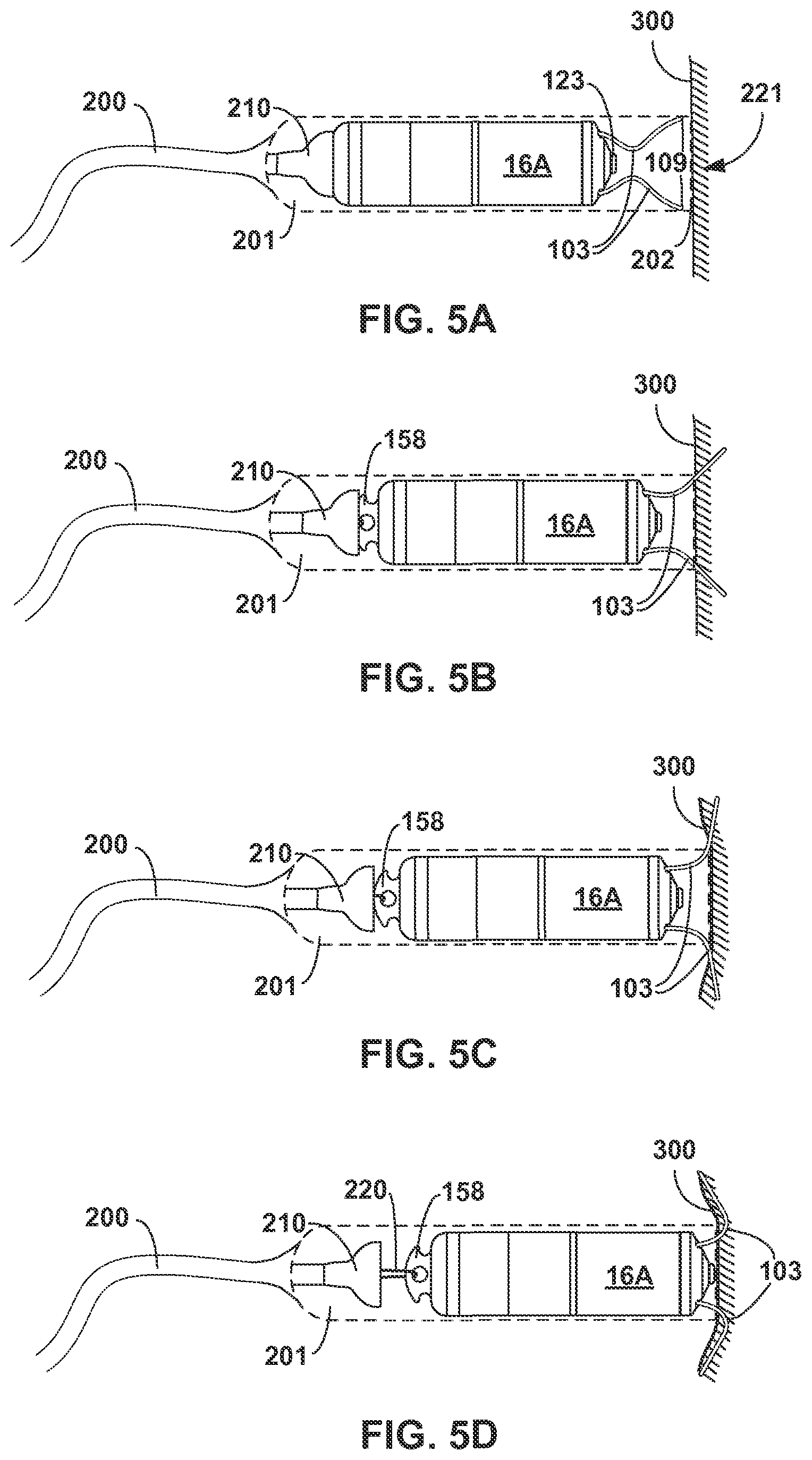 Patent US12157003 Figure 5 – Implantable medical device fixation