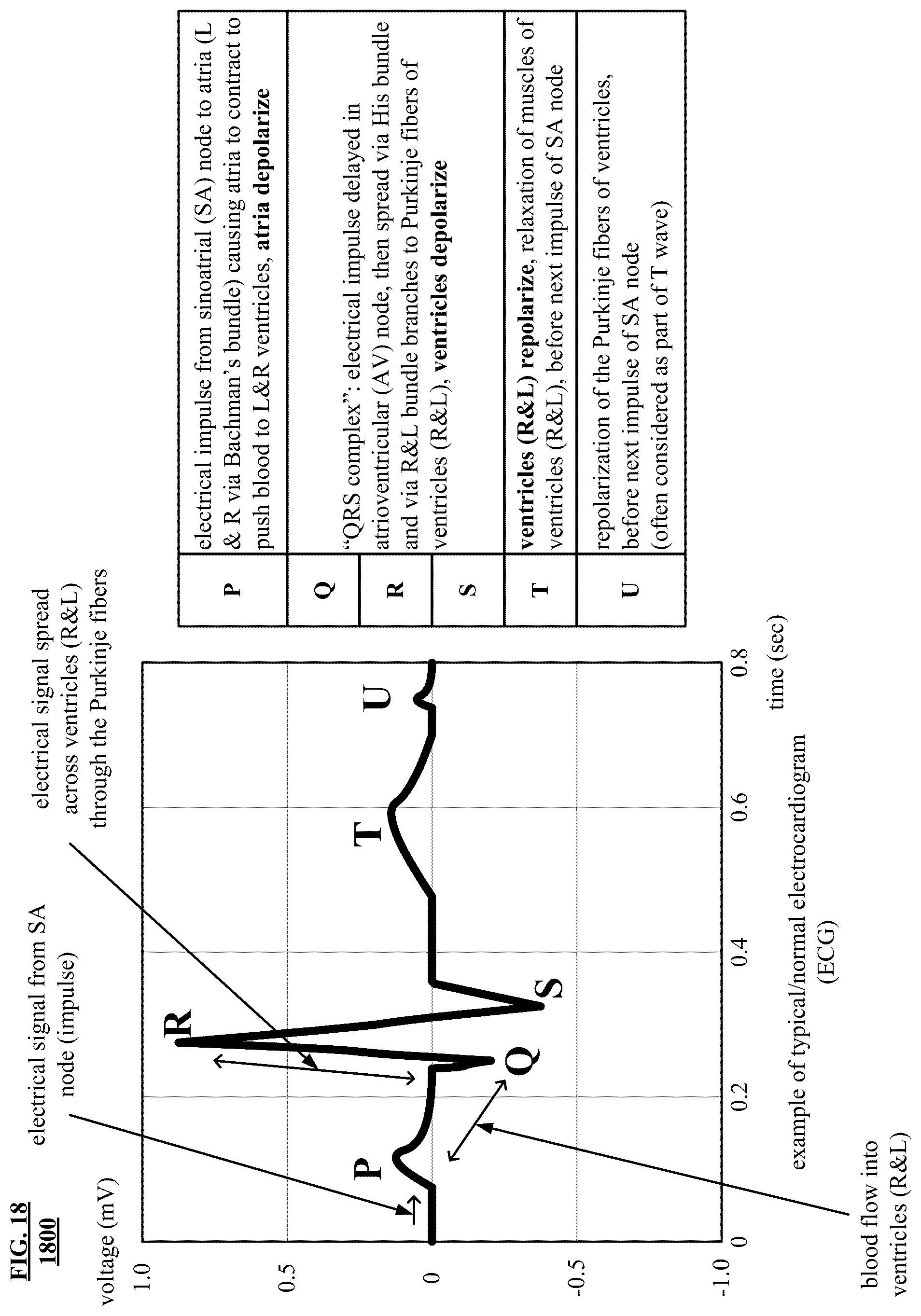 Patent US12157004 Figure 17 – Noninvasive heart and/or intrathoracic impedance sensor
