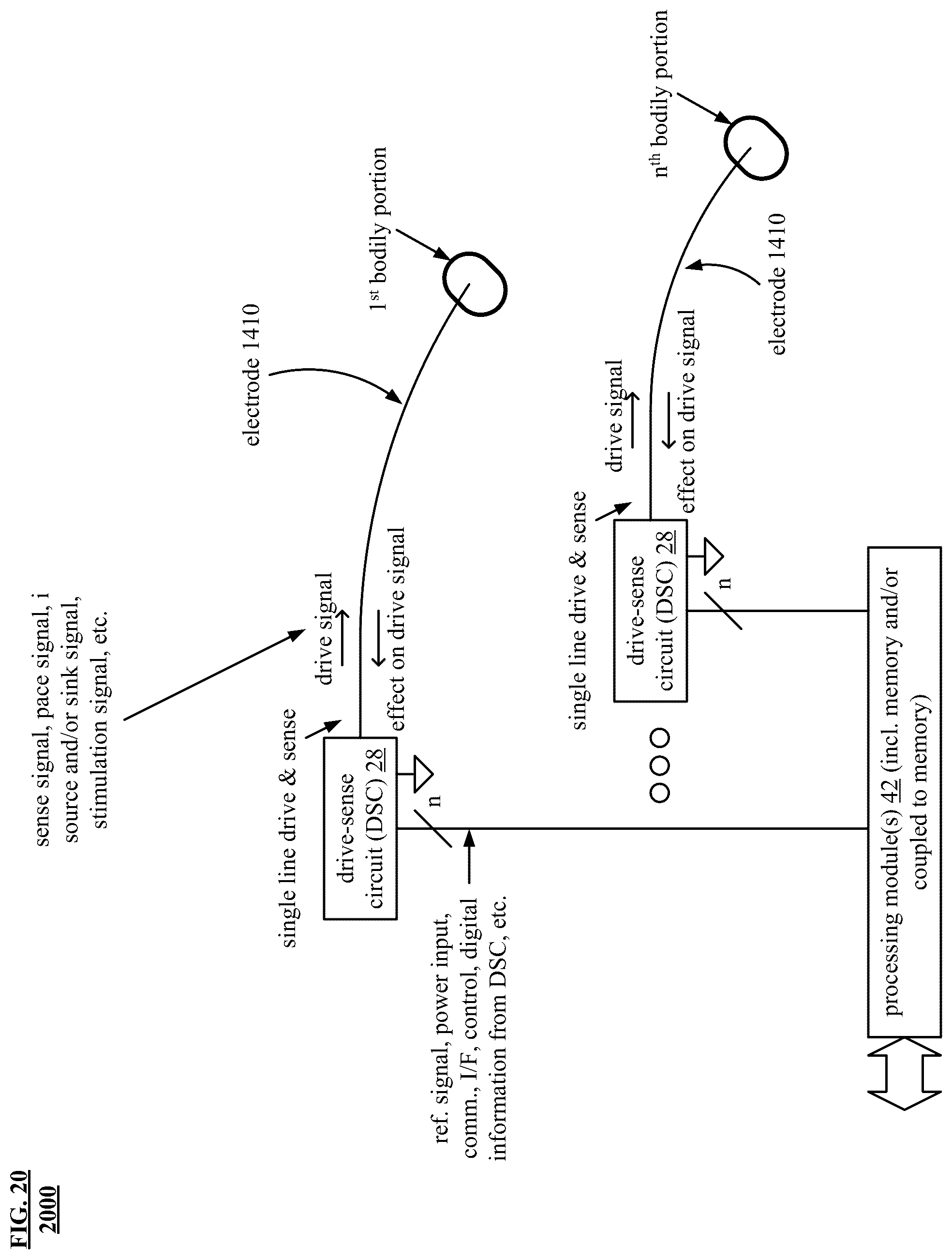 Patent US12157004 Figure 19 – Noninvasive heart and/or intrathoracic impedance sensor