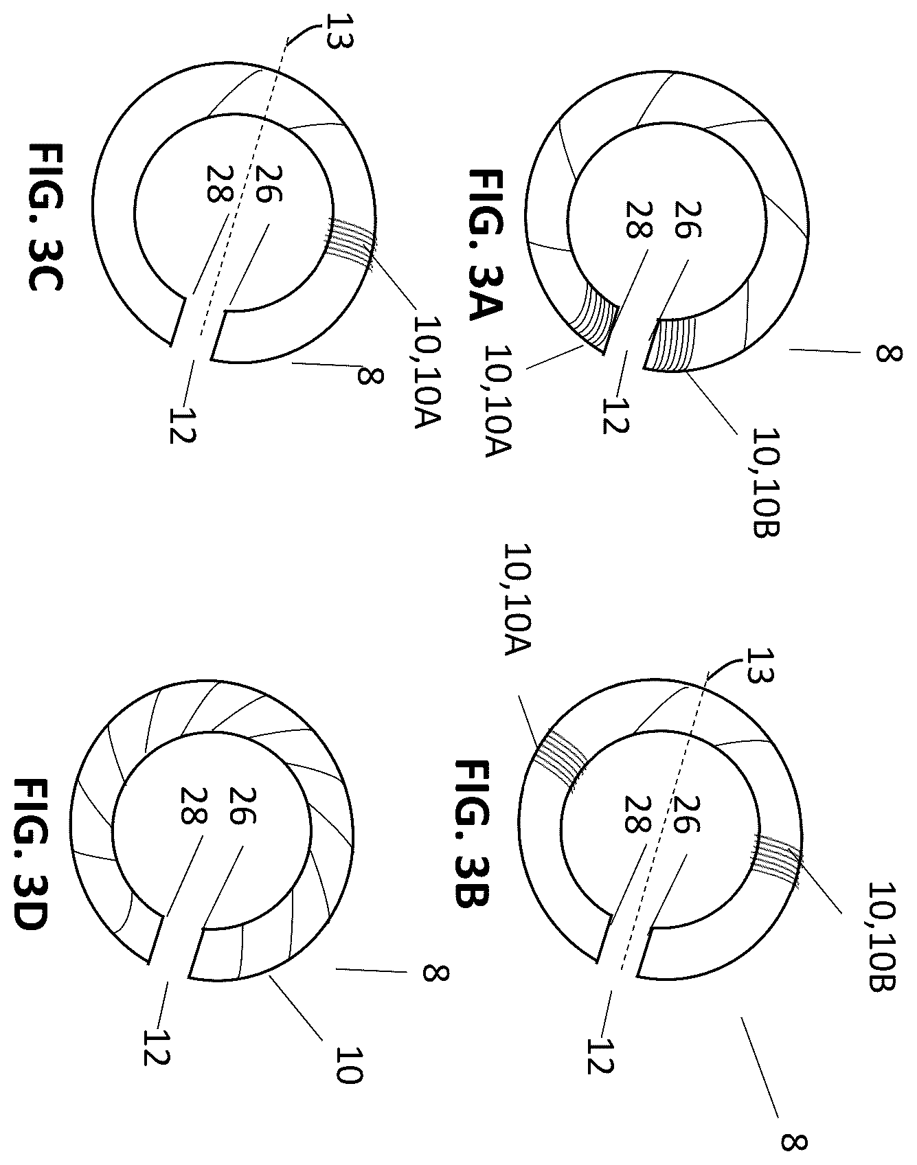 Patent US12157006 Figure 7 – Implantable hearing aid system comprising a wireless transcutaneous link