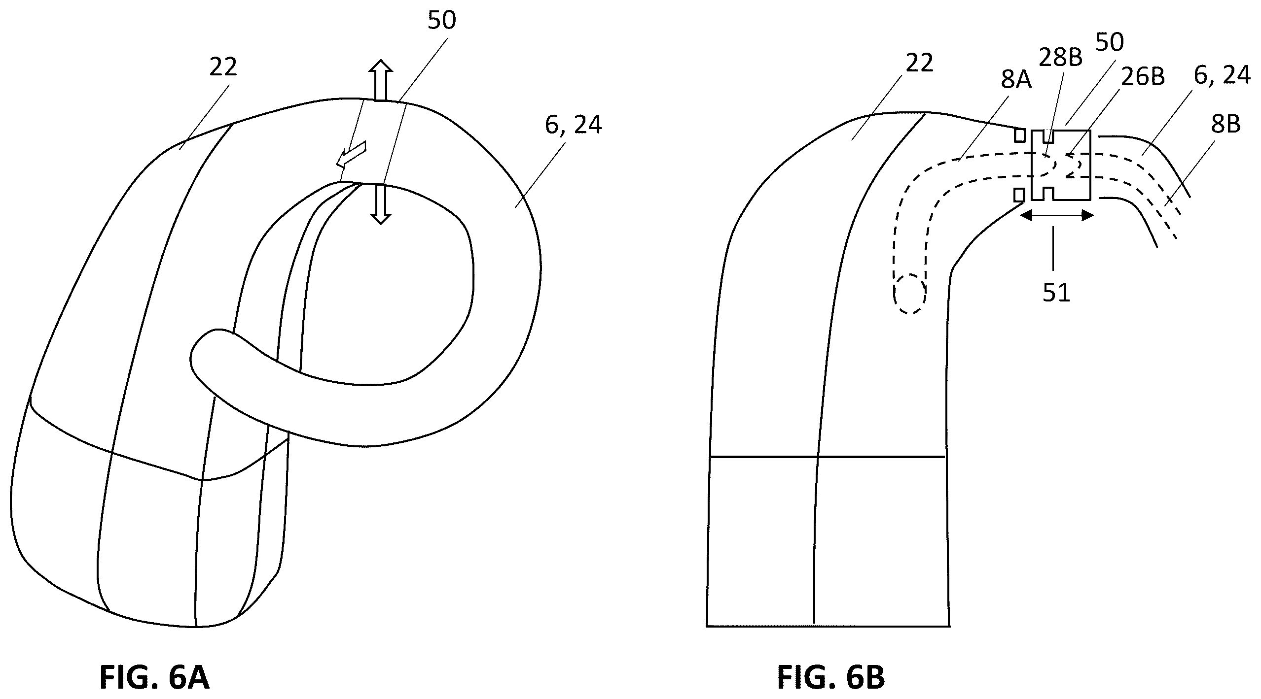 Patent US12157006 Figure 9 – Implantable hearing aid system comprising a wireless transcutaneous link