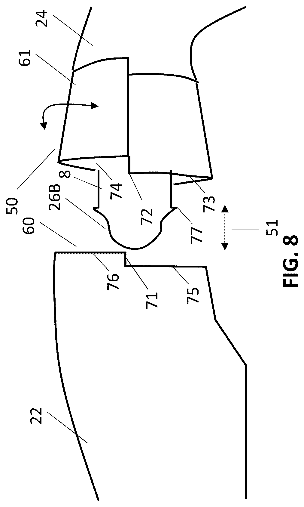 Patent US12157006 Figure 12 – Implantable hearing aid system comprising a wireless transcutaneous link