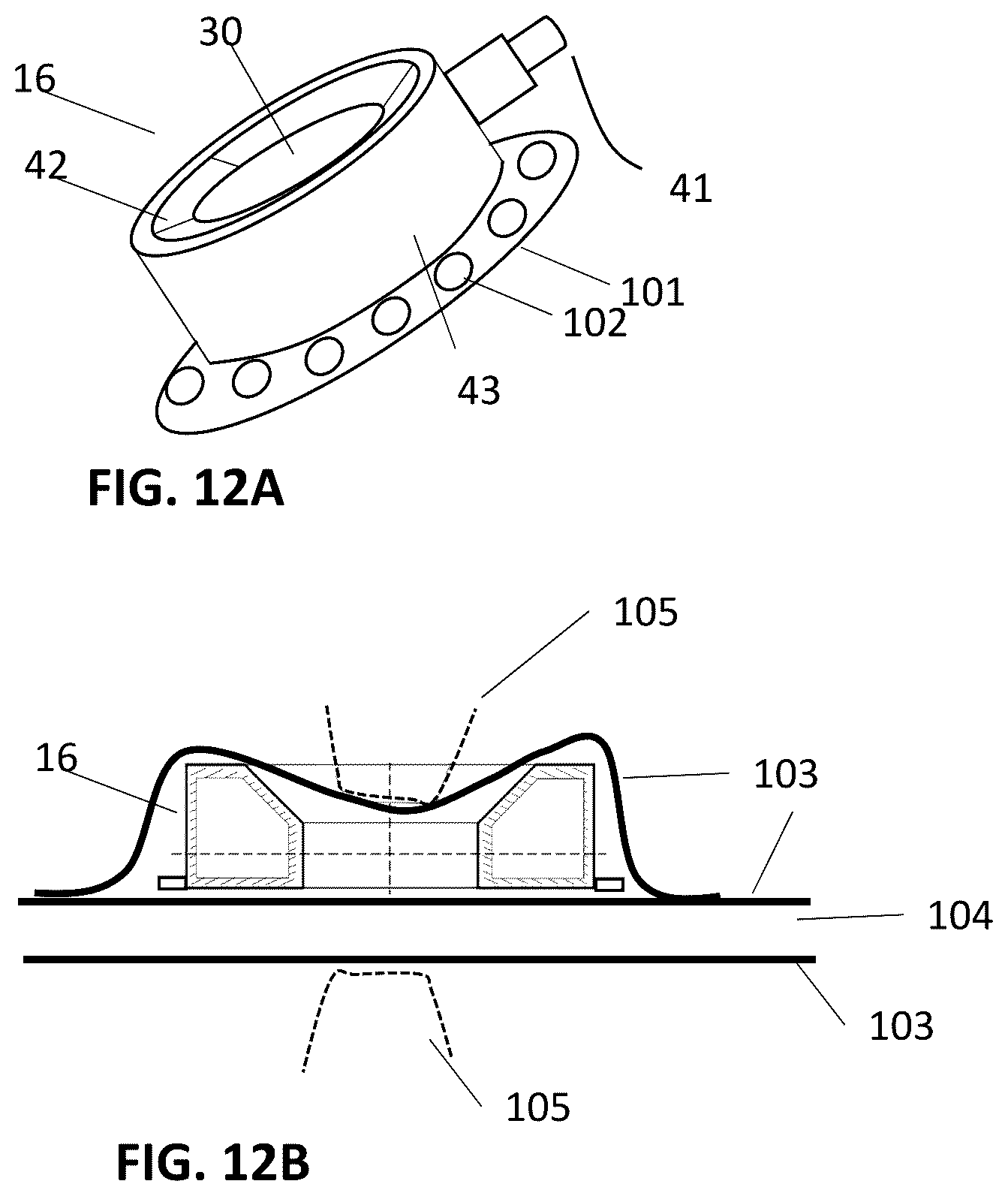 Patent US12157006 Figure 16 – Implantable hearing aid system comprising a wireless transcutaneous link
