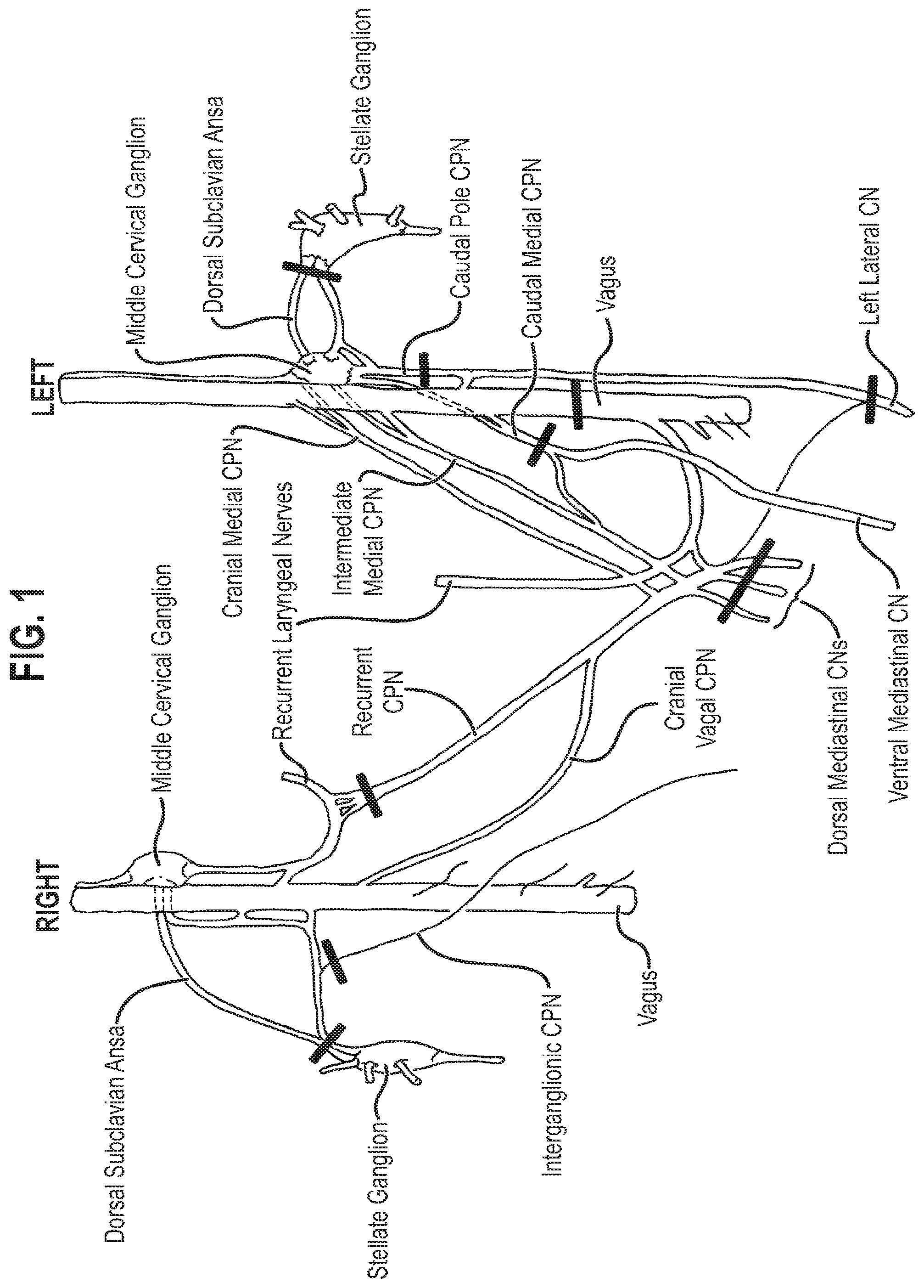 Patent US12157007 Figure 1 – Neuromodulation of ganglia
