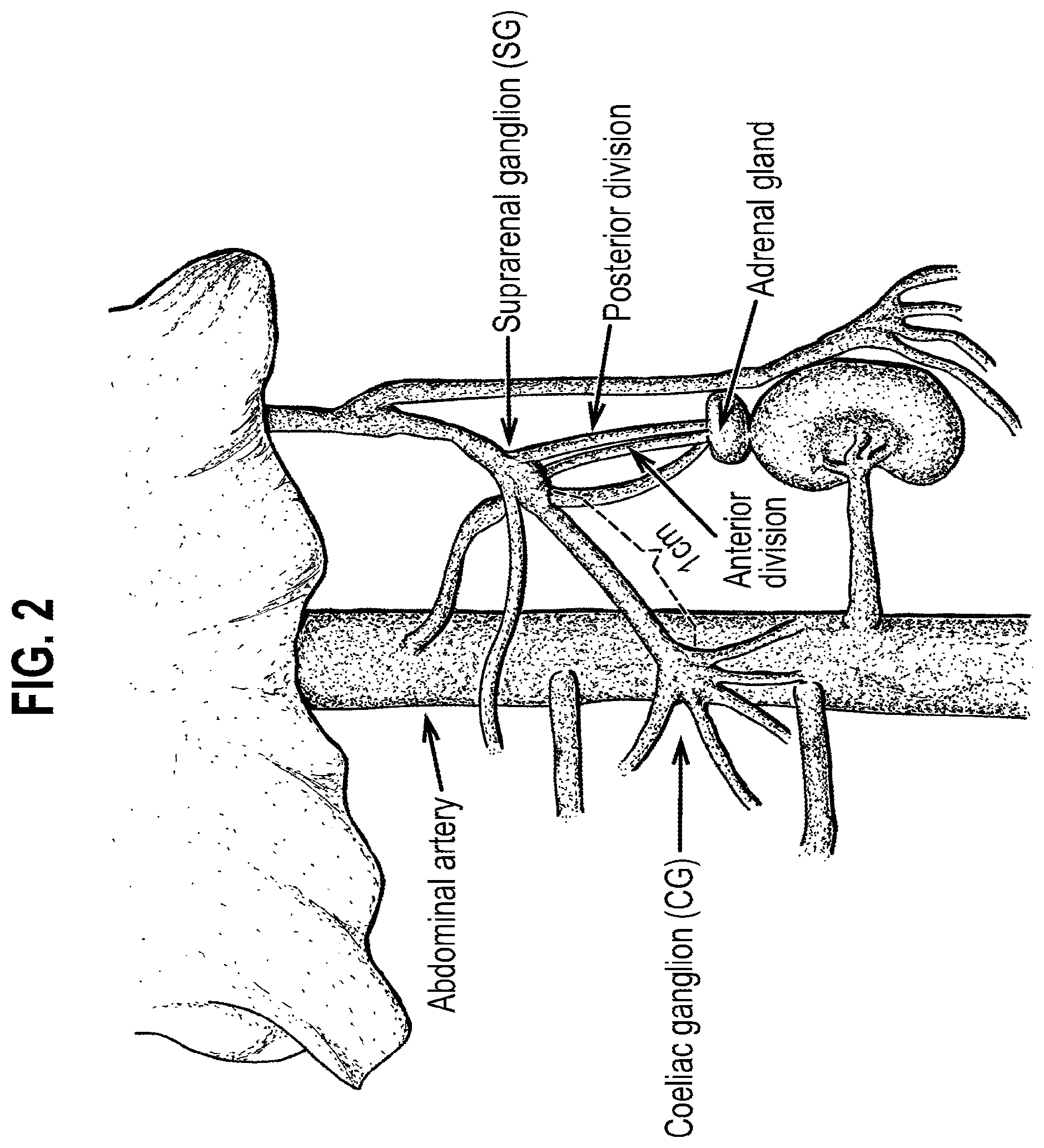 Patent US12157007 Figure 2 – Neuromodulation of ganglia