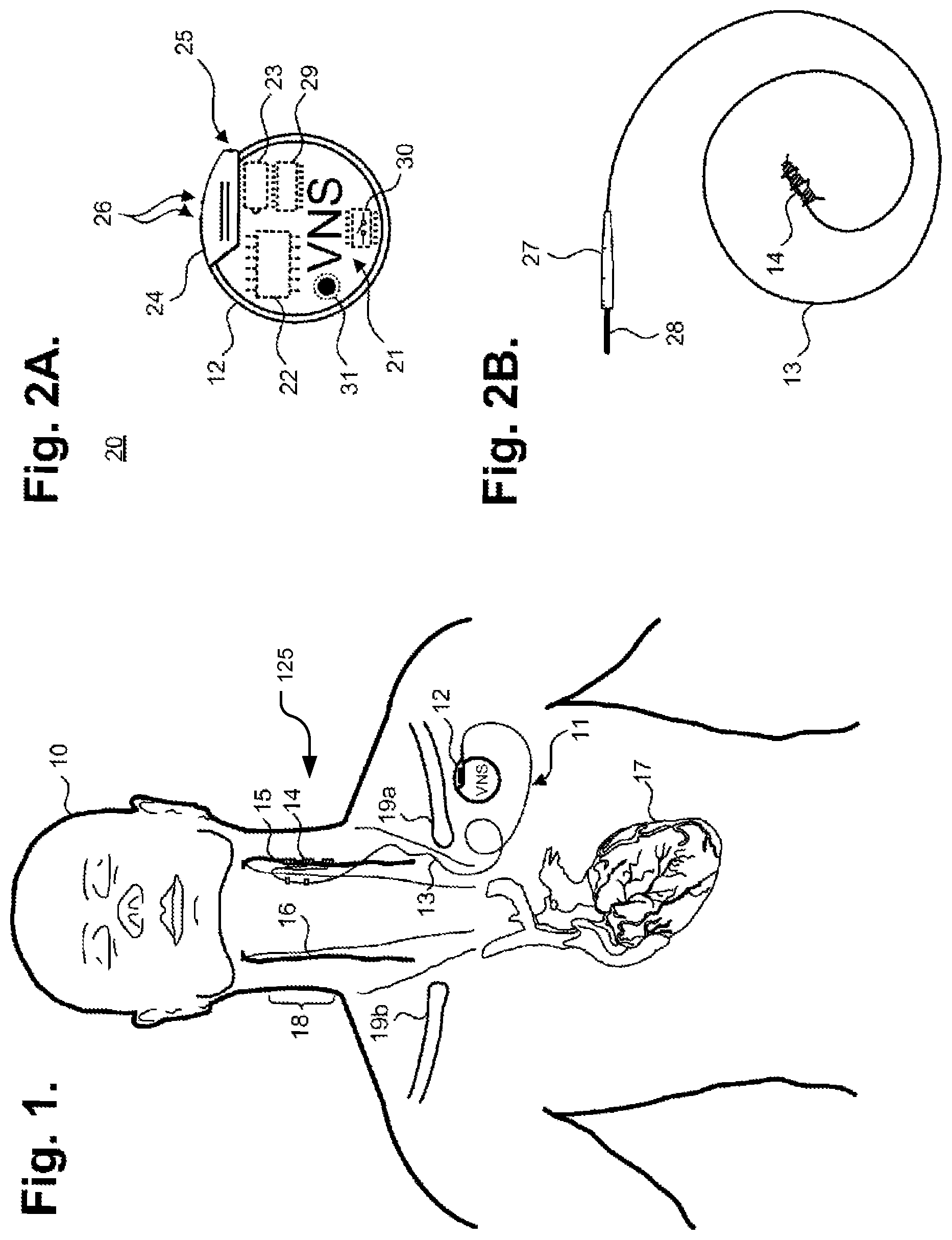 Patent US12157008 Figure 1 – Responsive neurostimulation for the treatment of chronic cardiac dysfunction