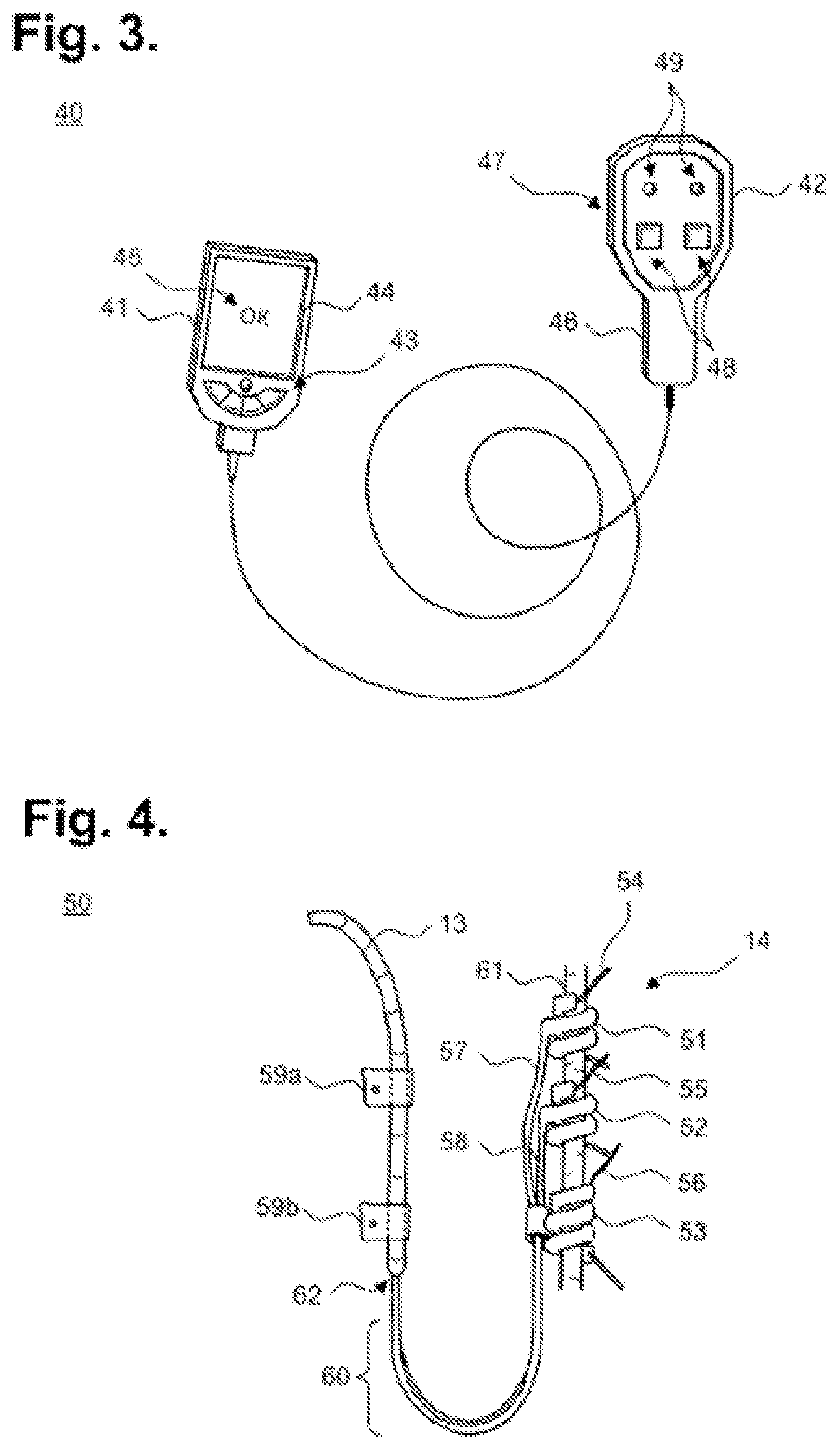 Patent US12157008 Figure 2 – Responsive neurostimulation for the treatment of chronic cardiac dysfunction