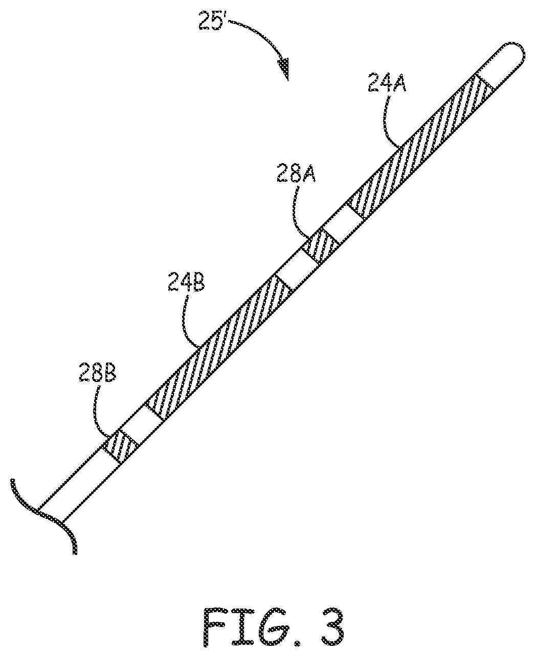 Patent US12157009 Figure 6 – Extra-cardiovascular pacing by an implantable cardioverter defibrillator