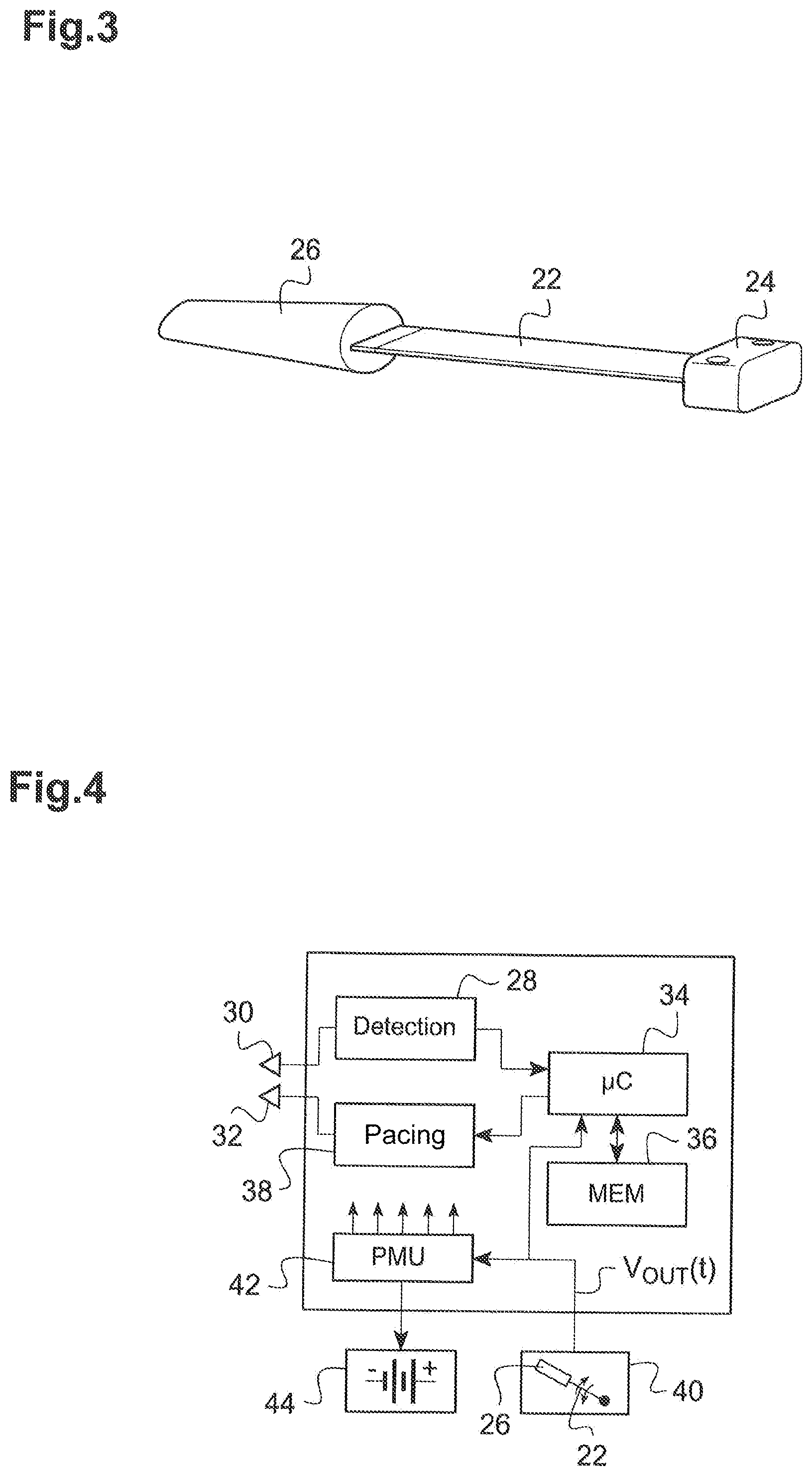 Patent US12157010 Figure 2 – Energy harvesting module with compact-construction piezoelectric transducer, in particular for powering a leadless autonomous cardiaccapsule