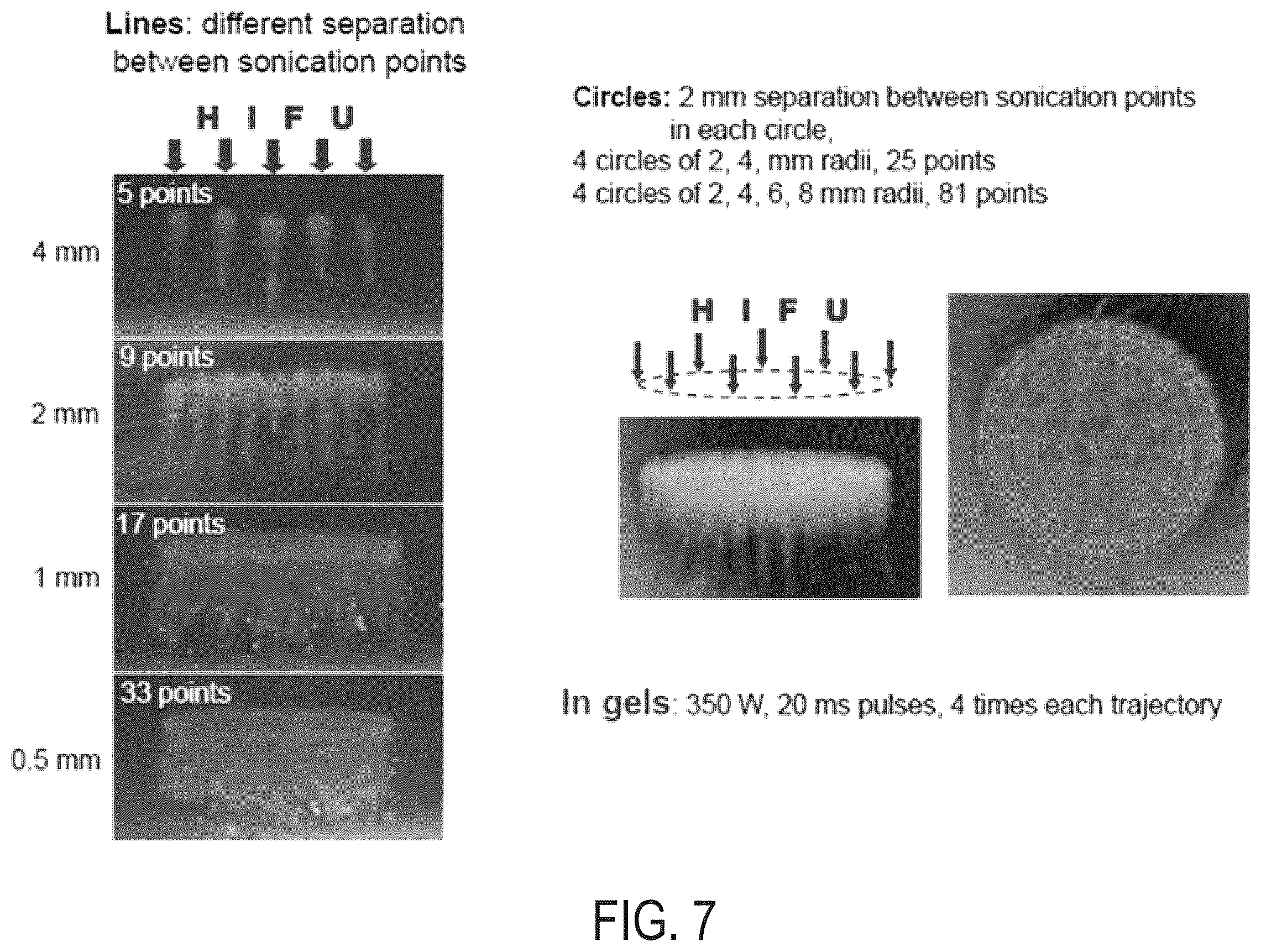 Patent US12157018 Figure 9 – Boiling histotripsy methods and systems for uniform volumetric ablation of an object by high-intensity focused ultrasound waves with shocks