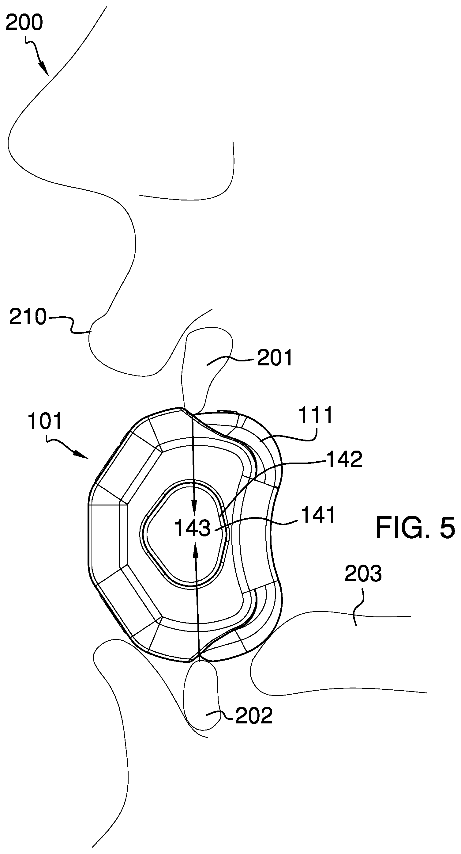 Patent US12157033 Figure 3 – Mouthpiece