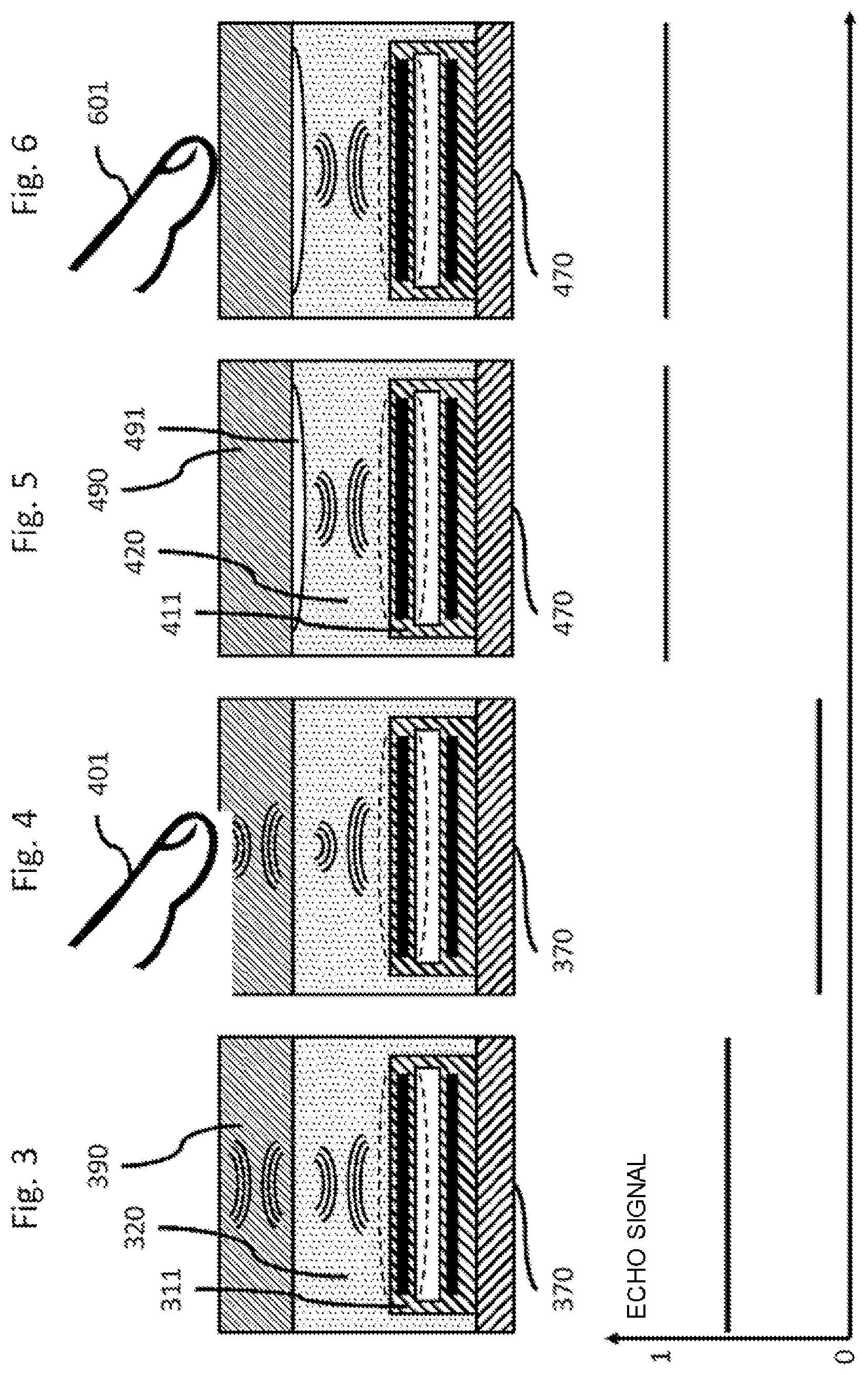 Patent US12157145 Figure 2 – Integration of a sensor system in a casing