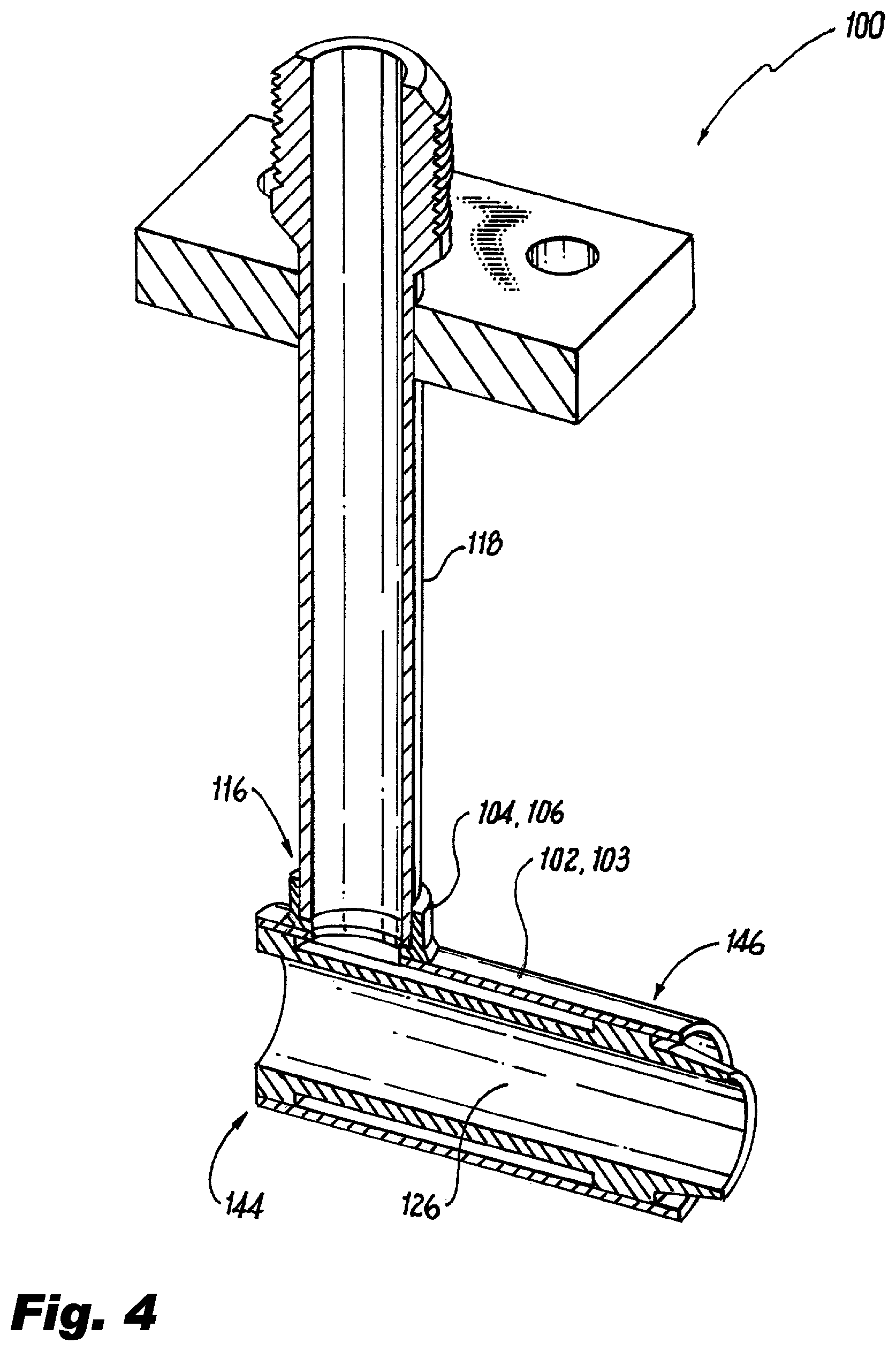 Patent US12157178 Figure 2 – Material deposition for fluid injectors