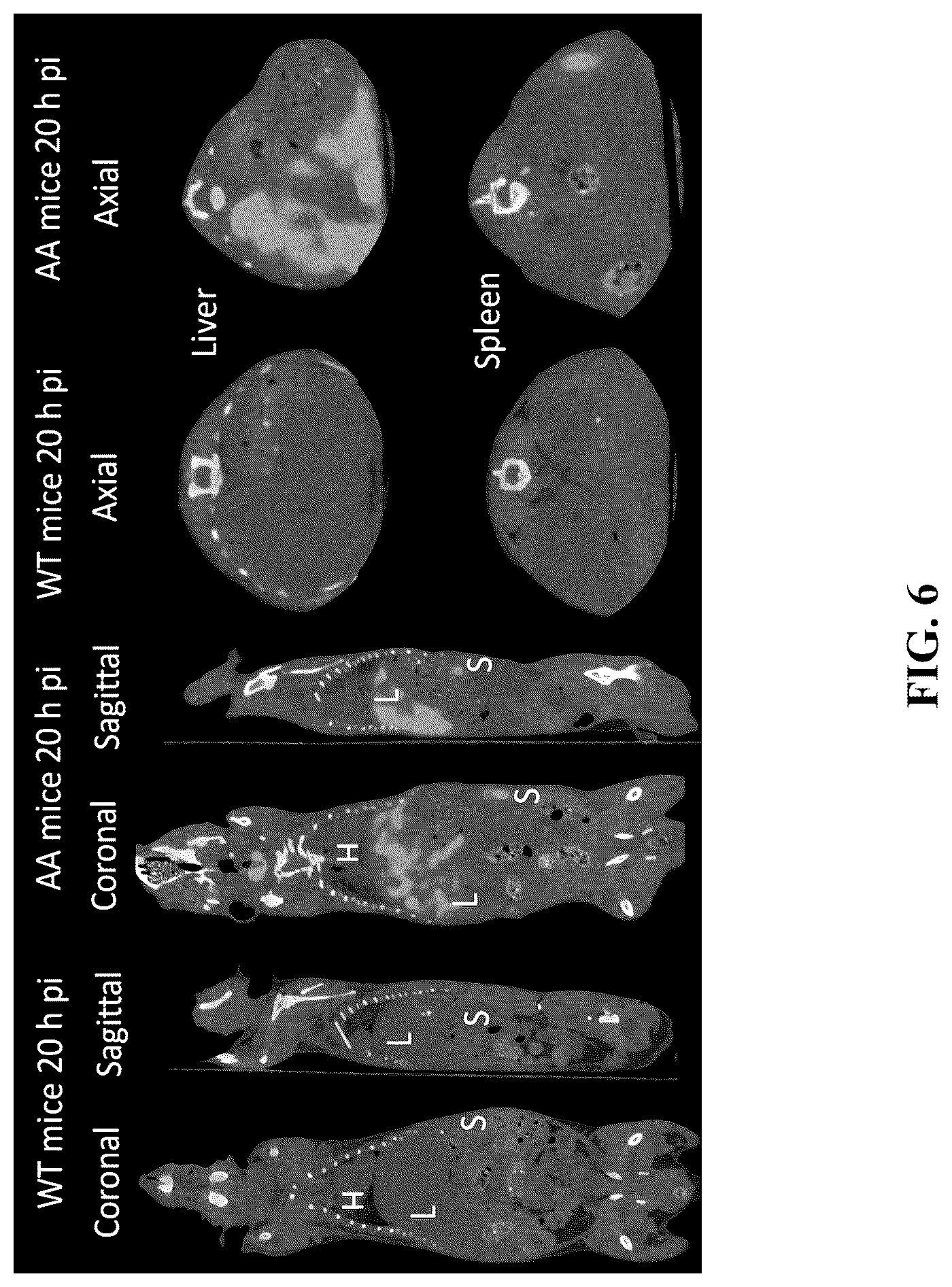 Patent US12157765 Figure 6 – Modified immunoglobulins for targeting amyloid deposits