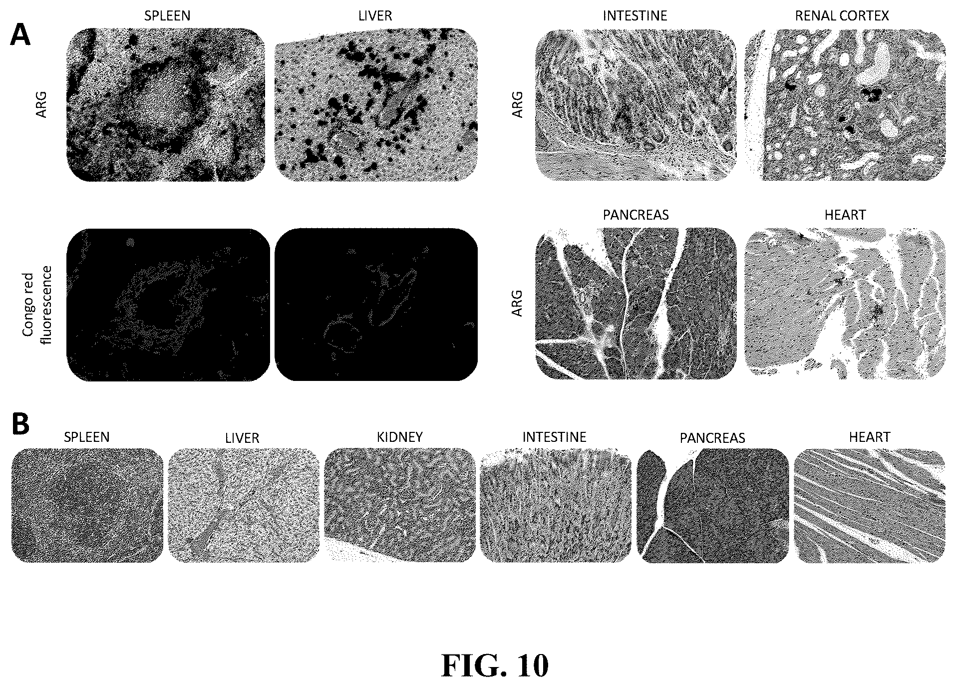 Patent US12157765 Figure 10 – Modified immunoglobulins for targeting amyloid deposits
