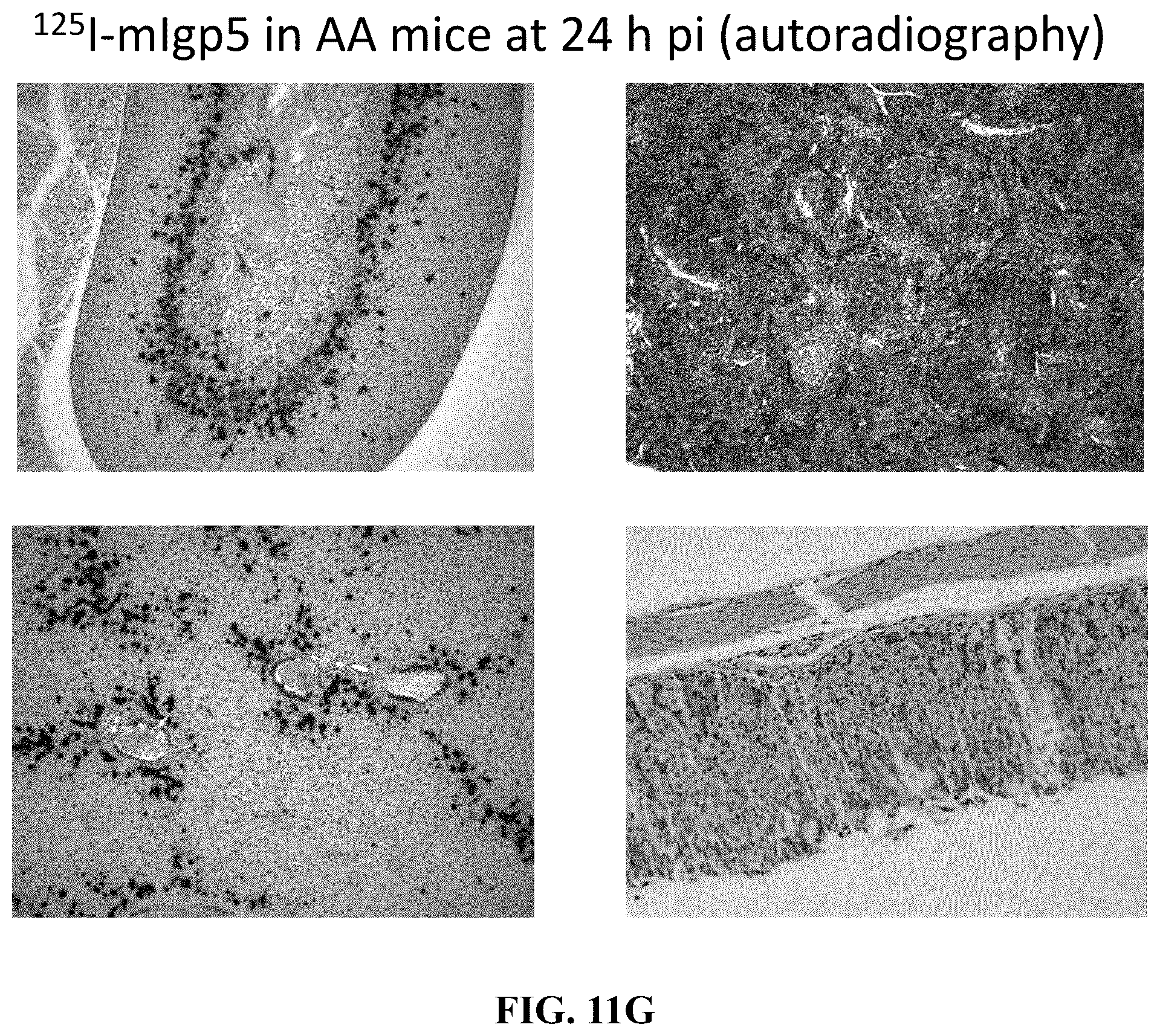 Patent US12157765 Figure 15 – Modified immunoglobulins for targeting amyloid deposits