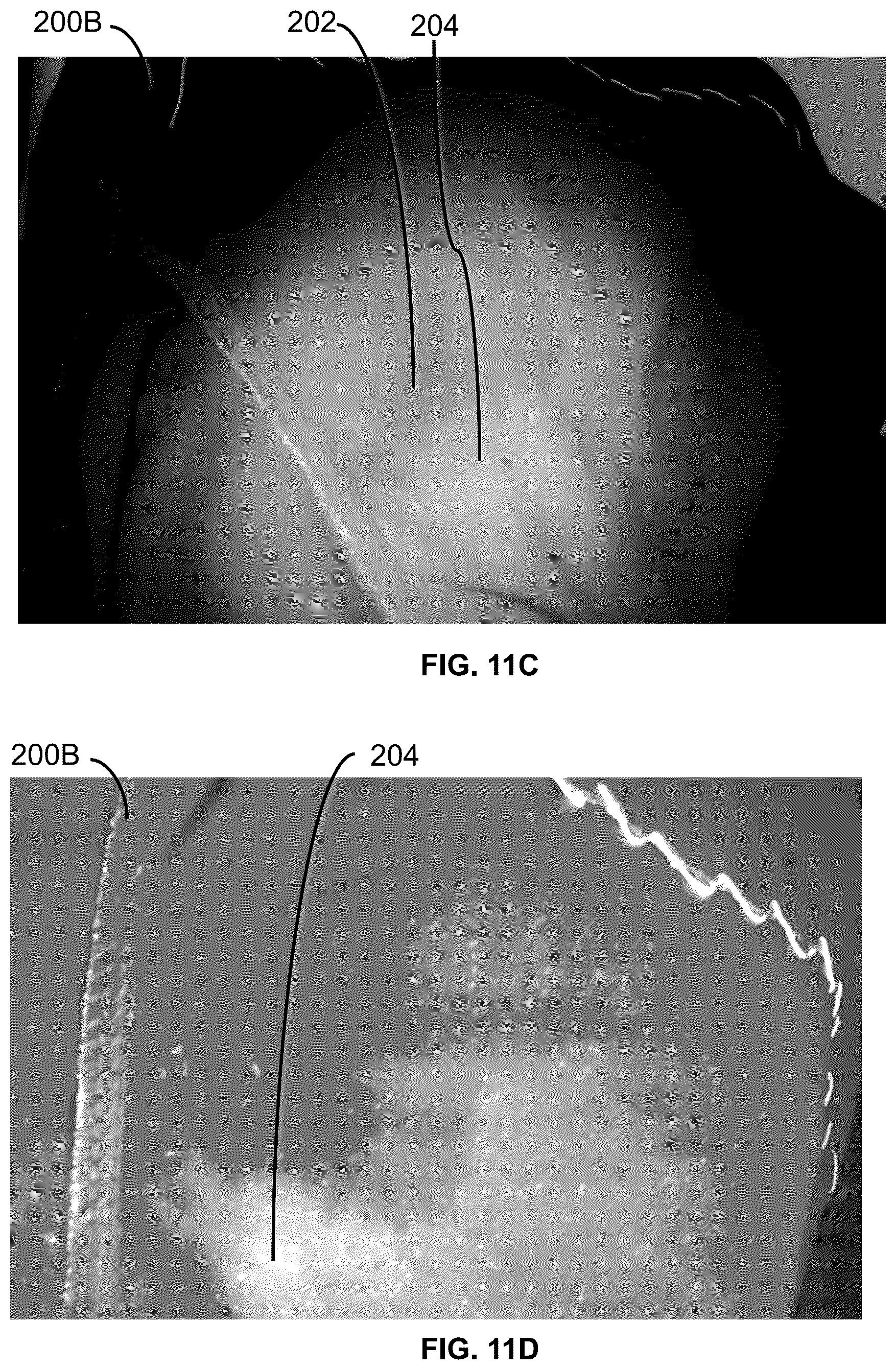 Patent US12157869 Figure 14 – Methods and compositions for reducing persistent odor in clothing and mitigating biofilms on various materials