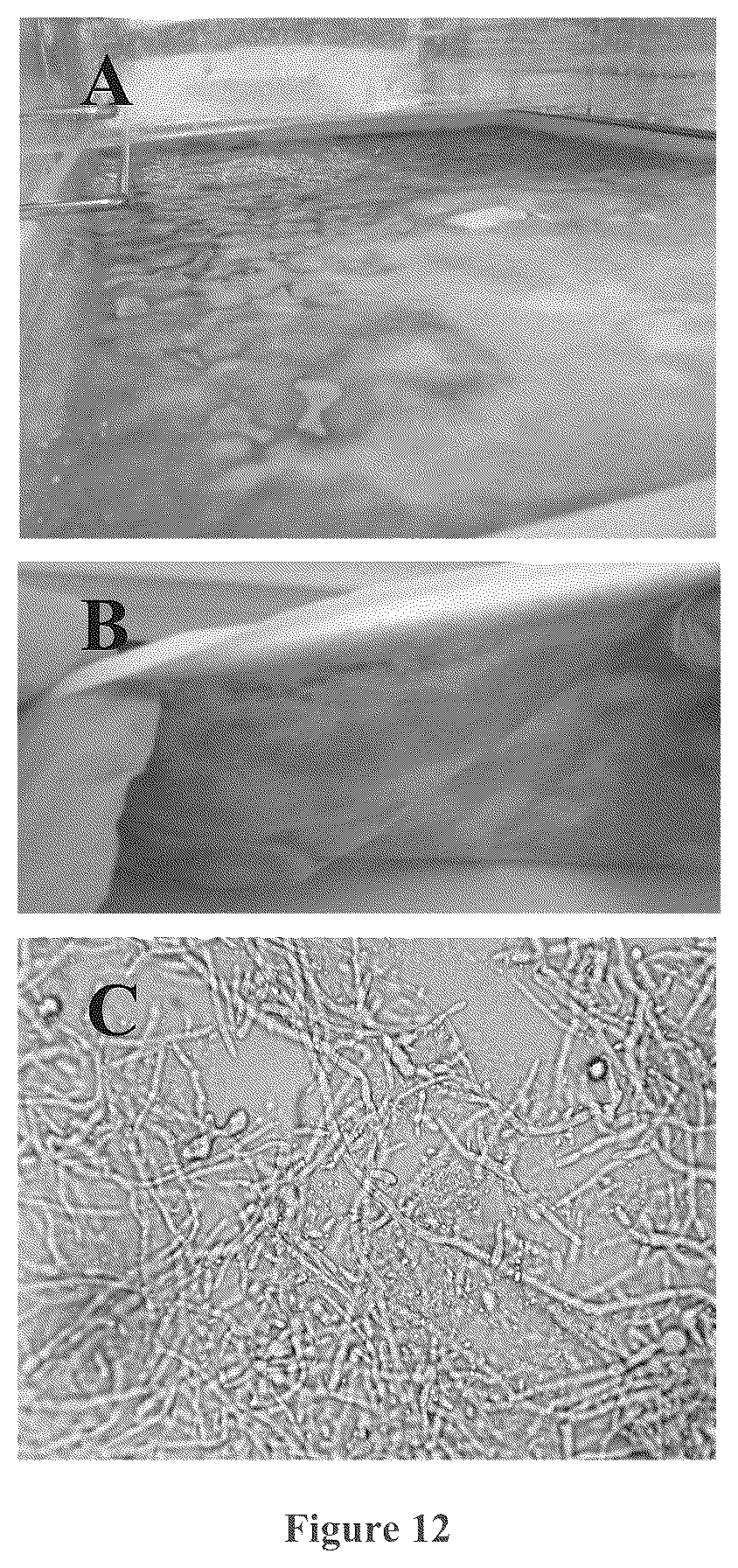 Patent US12157880 Figure 10 – Filamentous fungal biomats, methods of their production and methods of their use