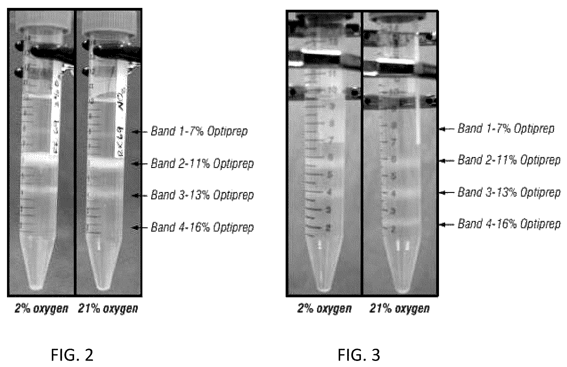Patent US12157887 Figure 2 – Bioactive renal cells