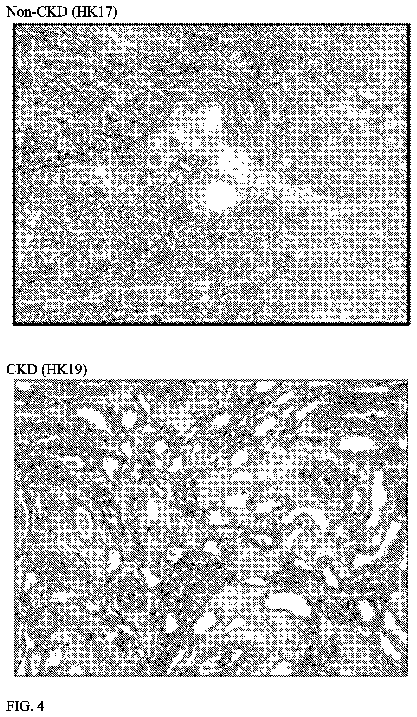 Patent US12157887 Figure 3 – Bioactive renal cells