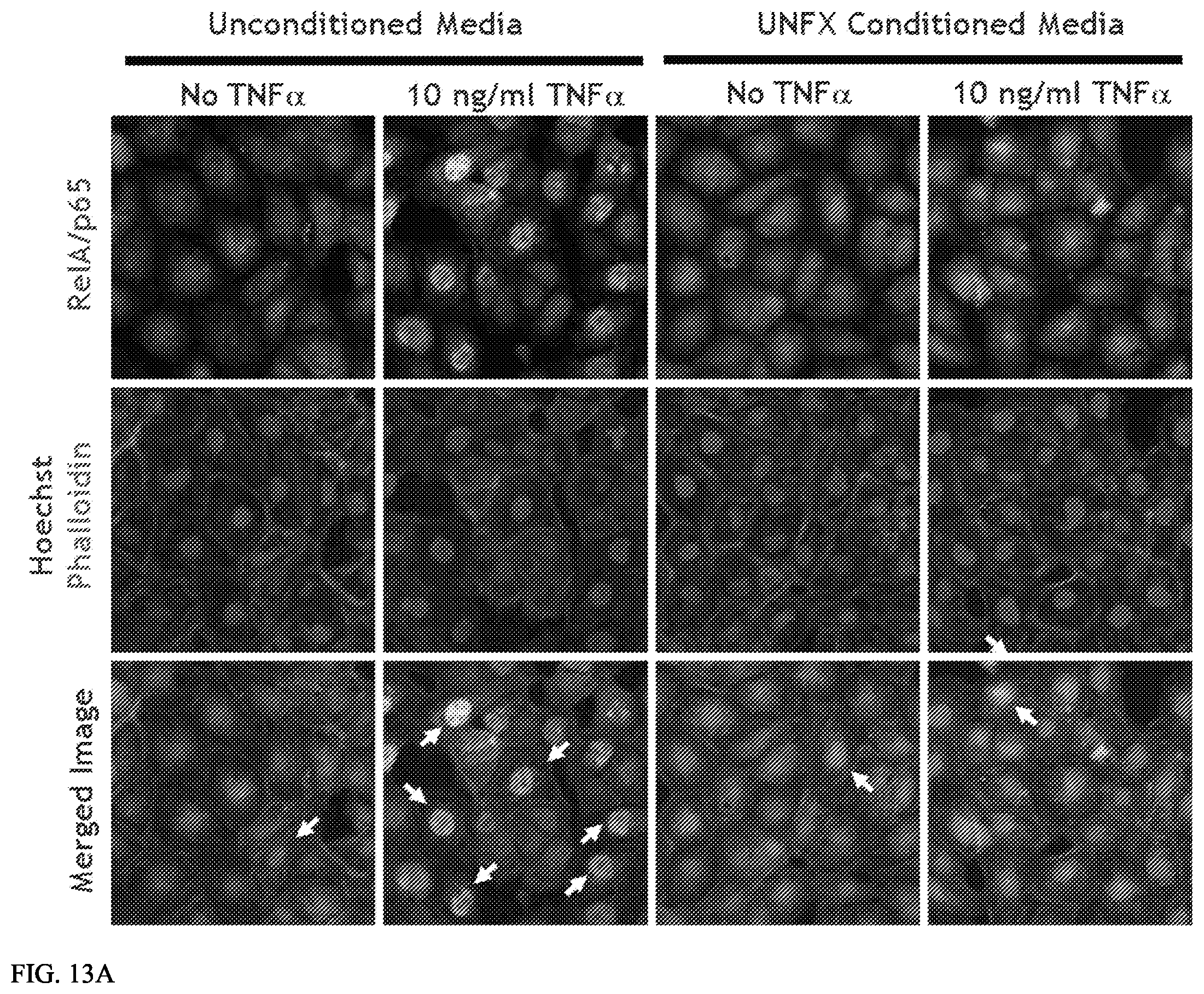 Patent US12157887 Figure 11 – Bioactive renal cells