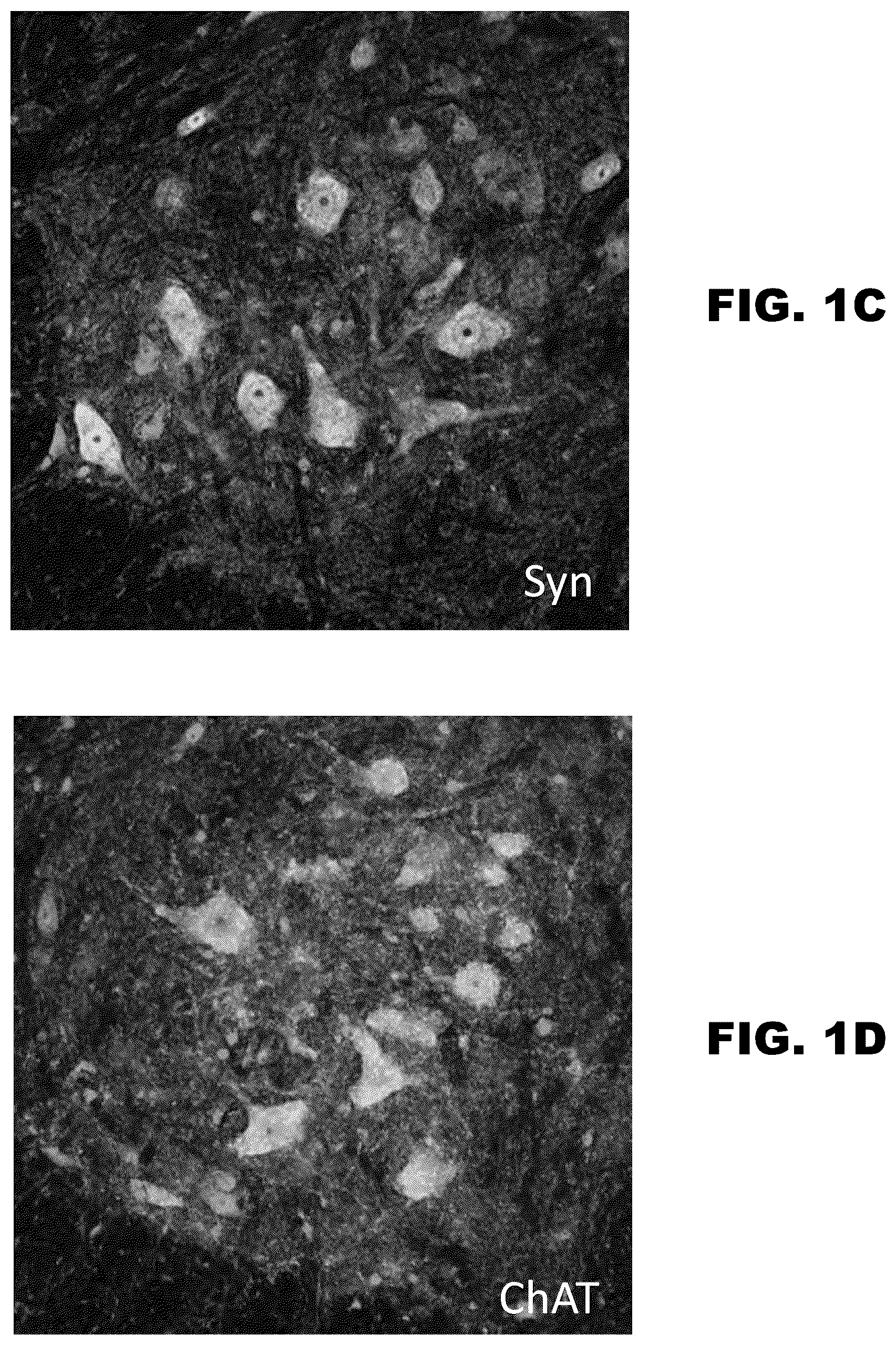 Patent US12157889 Figure 2 – Methods to detect motor neuron disease comprising micro-RNAs