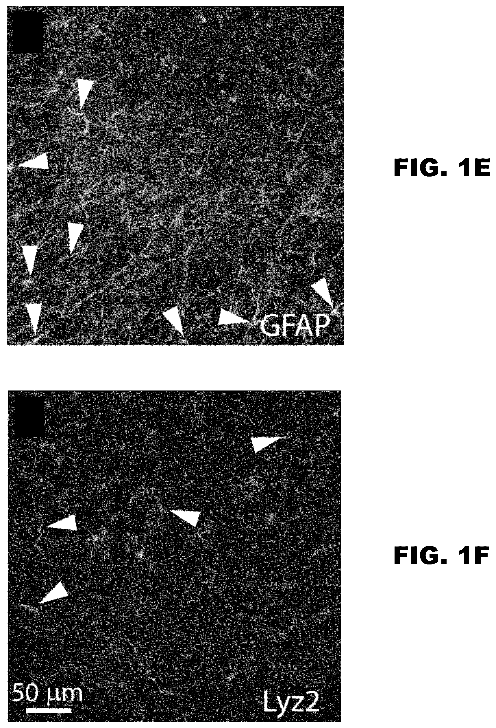 Patent US12157889 Figure 3 – Methods to detect motor neuron disease comprising micro-RNAs
