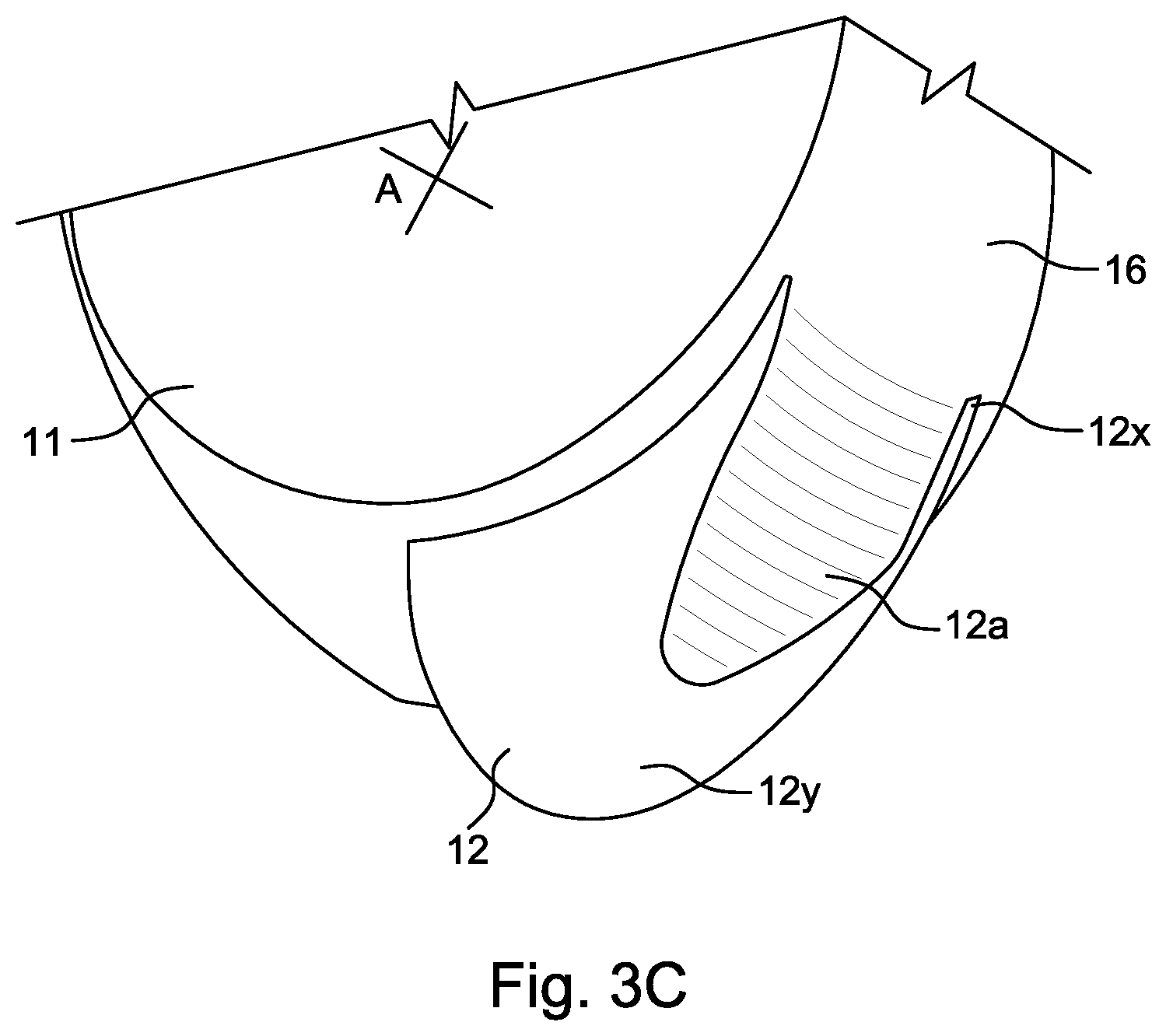 Patent US12158102 Figure 4 – Rotary drive apparatus