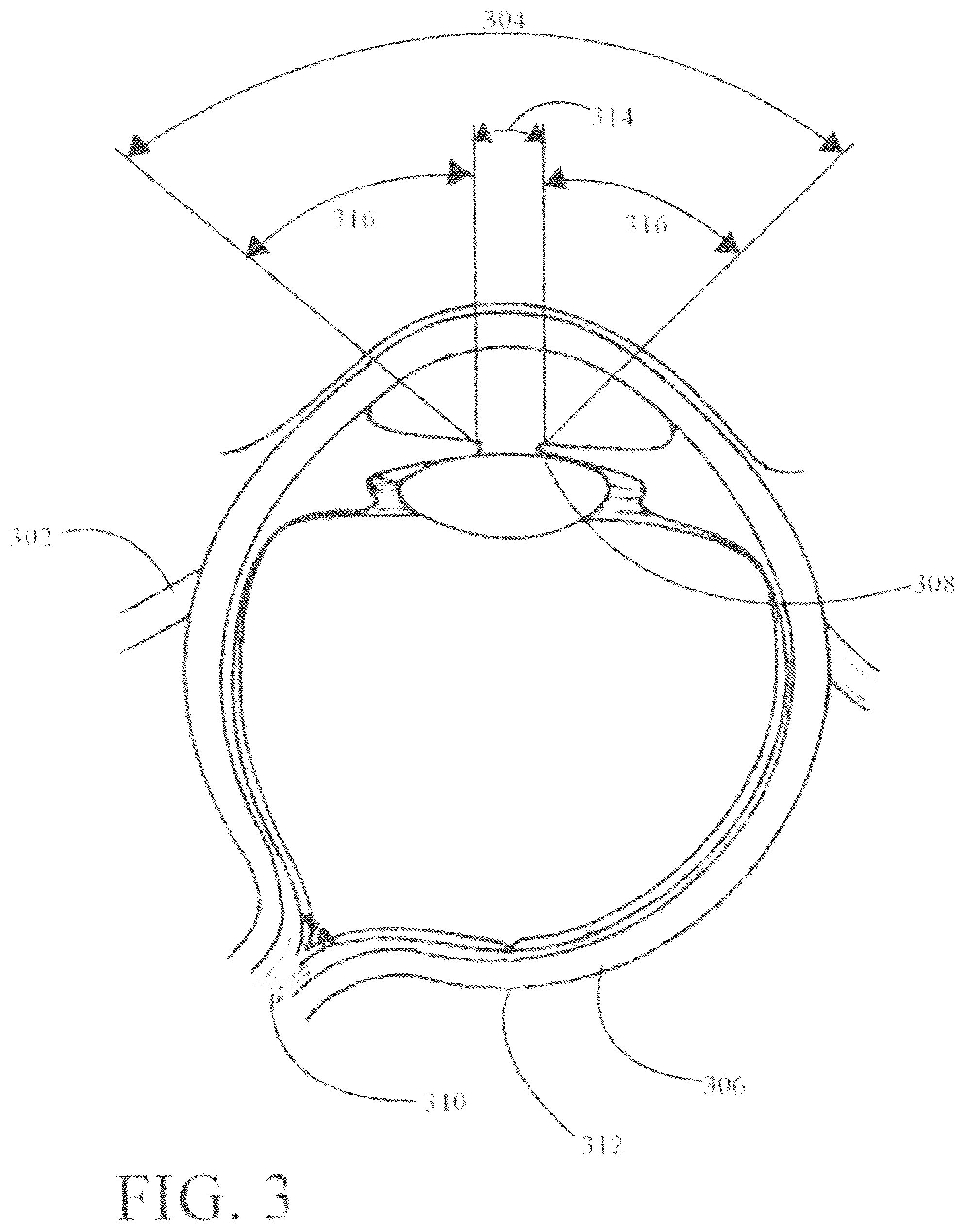 Patent US12158587 Figure 3 – System for and method of projecting augmentation imagery in a head-mounted display