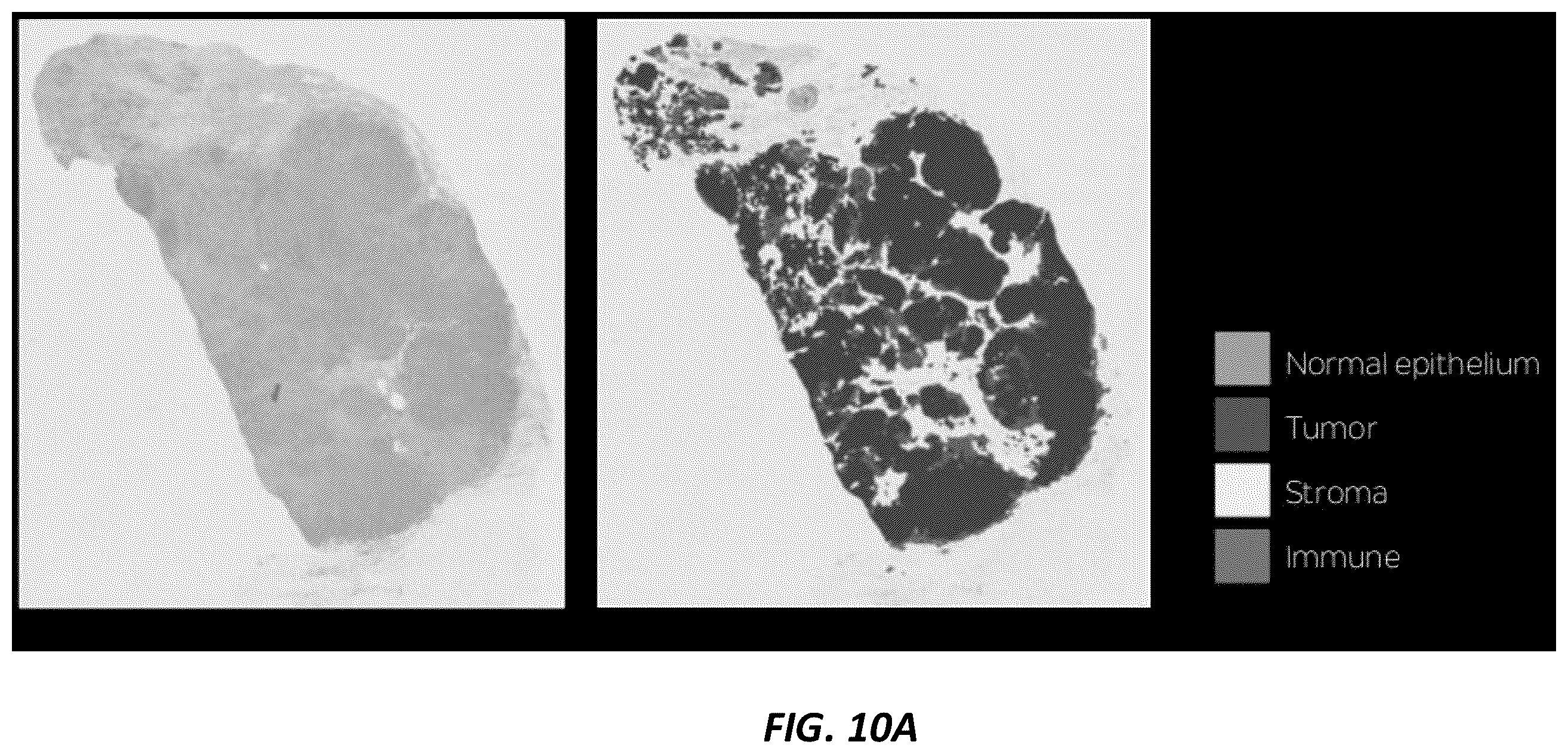 Patent US12165236 Figure 10 – Predicting total nucleic acid yield and dissection boundaries for histology slides