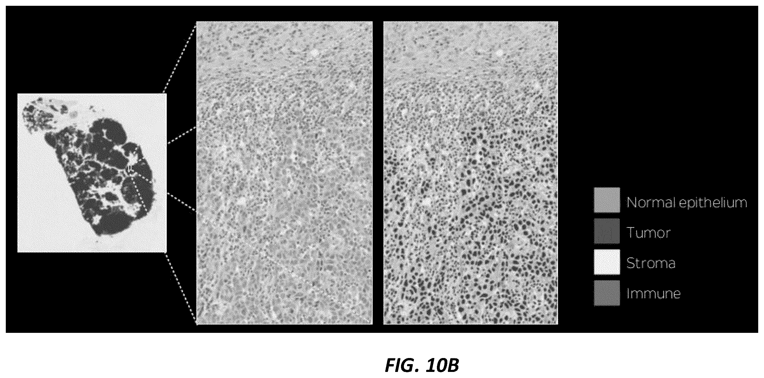 Patent US12165236 Figure 11 – Predicting total nucleic acid yield and dissection boundaries for histology slides