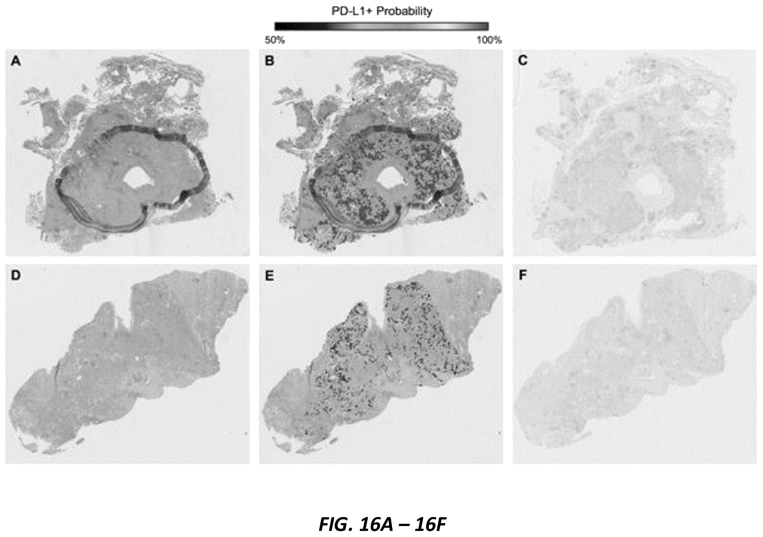 Patent US12165236 Figure 20 – Predicting total nucleic acid yield and dissection boundaries for histology slides
