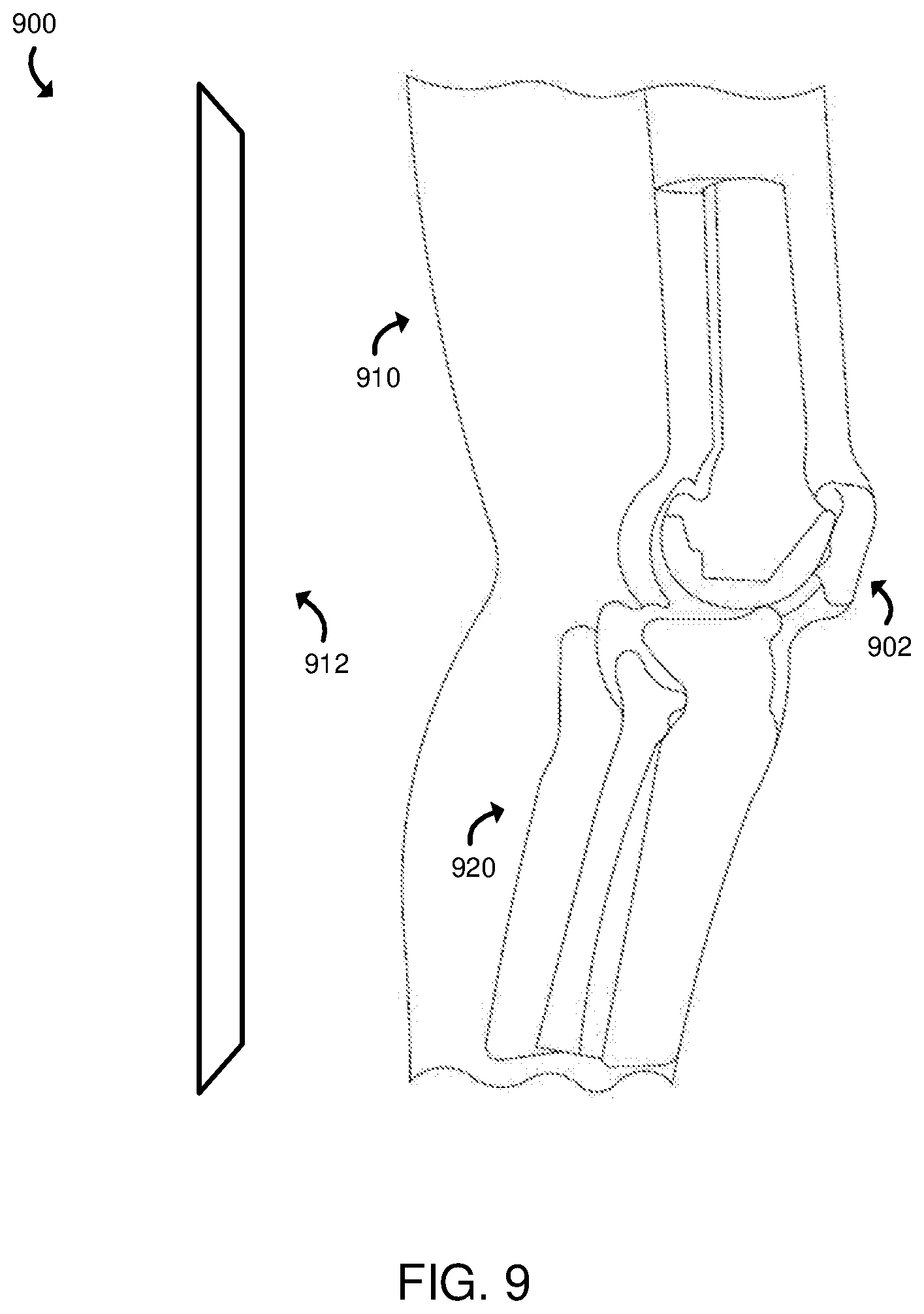 Patent US12165301 Figure 9 – Technologies for determining the accuracy of three-dimensional models for use in an orthopedic surgical procedure