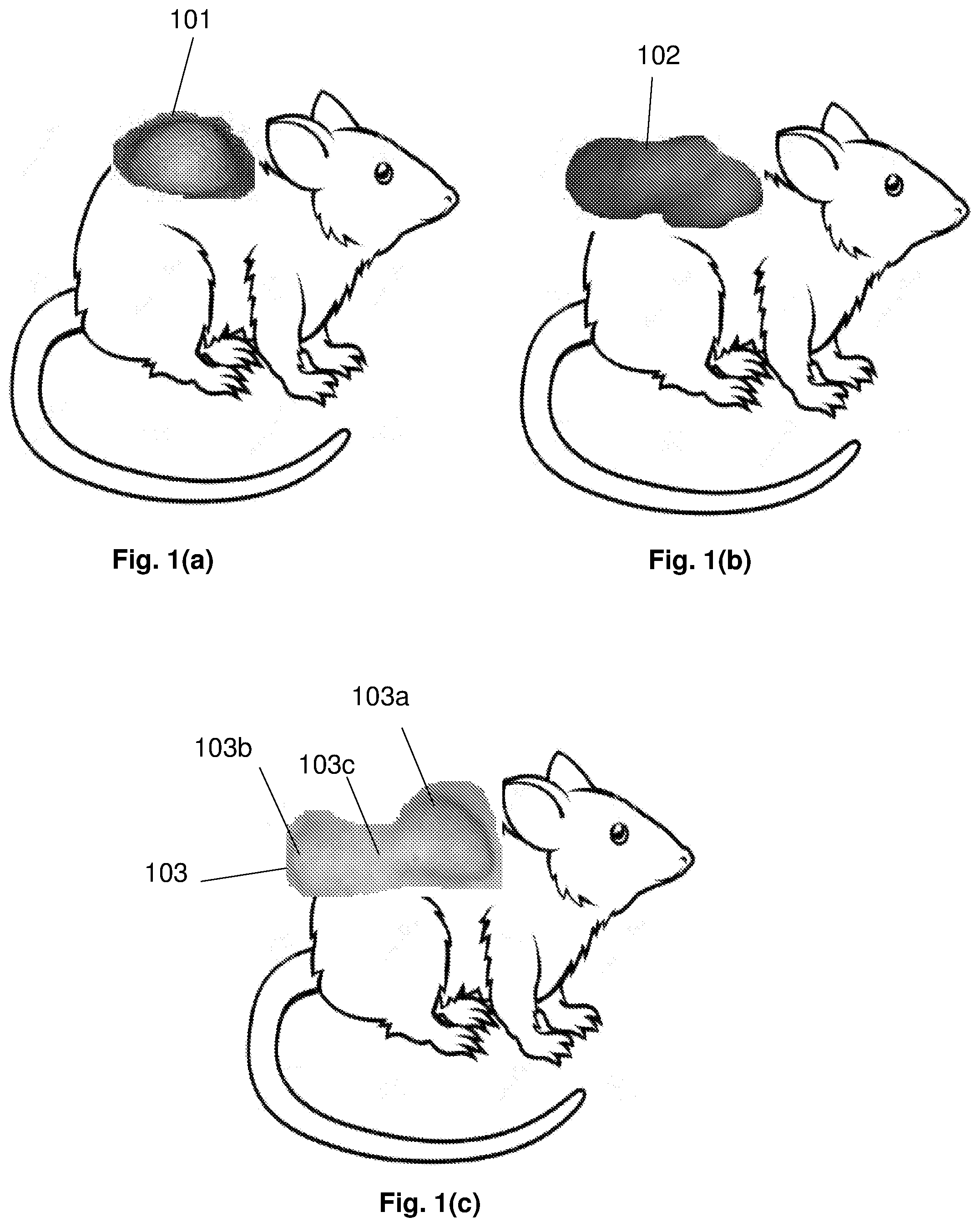 Patent US12165309 Figure 1 – Deformity edge detection